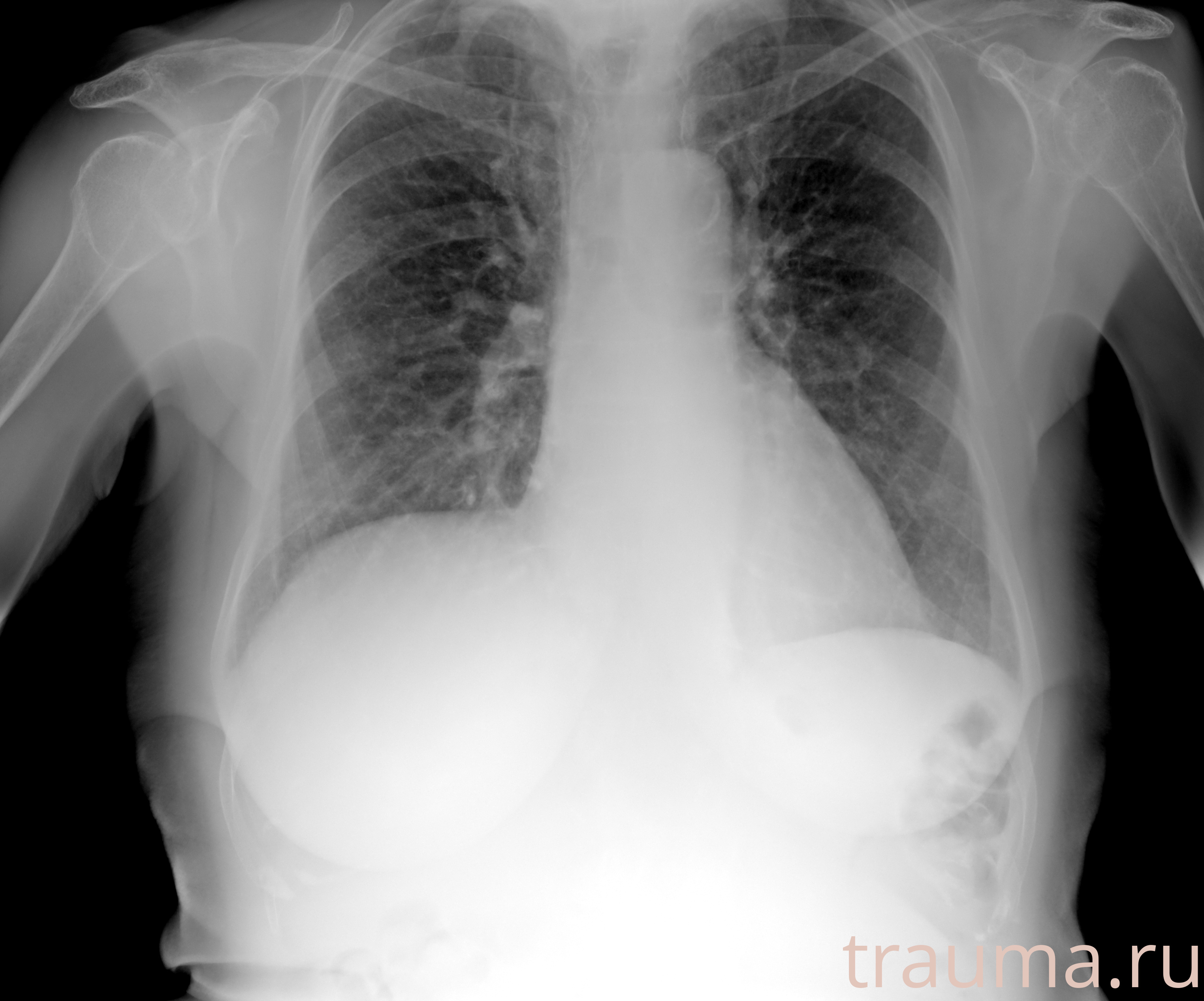 Рентген на дому: по вашему адресу приезжает врач-рентгенолог, травматолог-ортопед с мобильным рентгеновским аппаратом, проводит диагностику травмы или заболевания, делает необходимые рентгенограммы, дает рекомендации по дальнейшему лечению. Получить качественные снимки в домашних условиях возможно благодаря уникальной методике, разработанной МосРентген Центром для института  Склифосовского