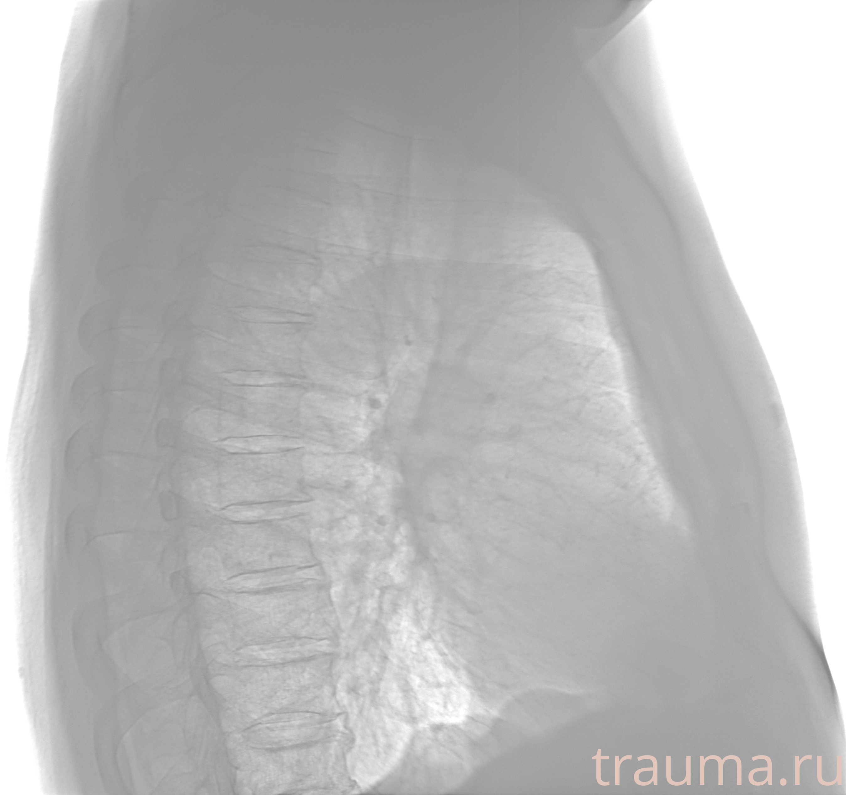 Рентген на дому: по вашему адресу приезжает врач-рентгенолог, травматолог-ортопед с мобильным рентгеновским аппаратом, проводит диагностику травмы или заболевания, делает необходимые рентгенограммы, дает рекомендации по дальнейшему лечению. Получить качественные снимки в домашних условиях возможно благодаря уникальной методике, разработанной МосРентген Центром для института  Склифосовского