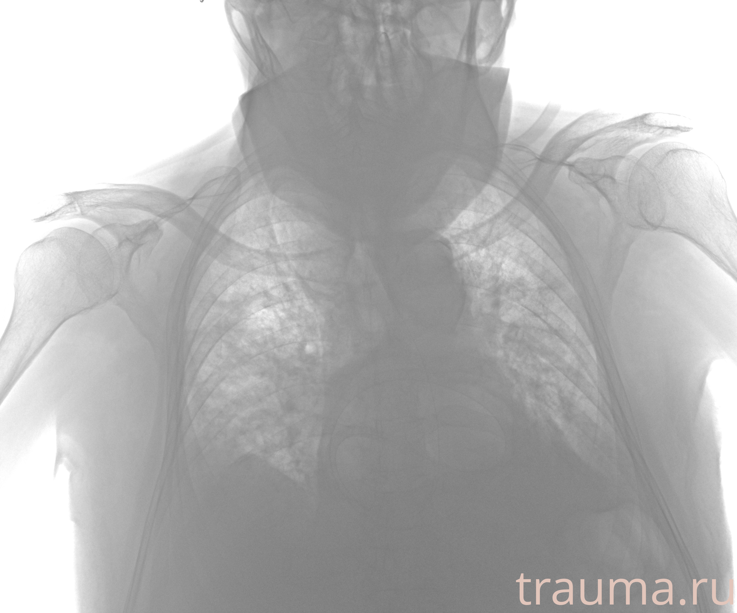 Рентген на дому: по вашему адресу приезжает врач-рентгенолог, травматолог-ортопед с мобильным рентгеновским аппаратом, проводит диагностику травмы или заболевания, делает необходимые рентгенограммы, дает рекомендации по дальнейшему лечению. Получить качественные снимки в домашних условиях возможно благодаря уникальной методике, разработанной МосРентген Центром для института  Склифосовского