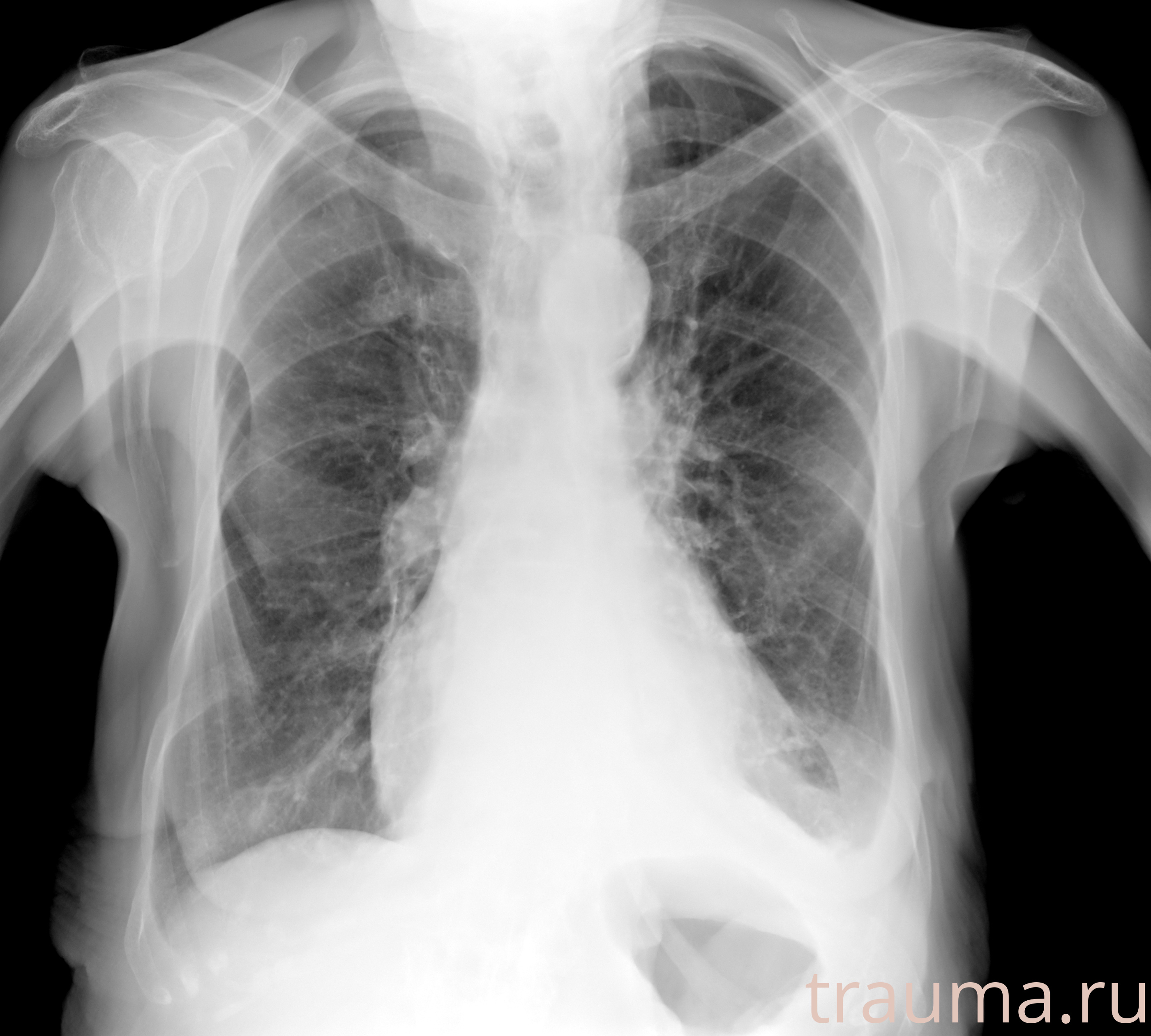 Рентген на дому: по вашему адресу приезжает врач-рентгенолог, травматолог-ортопед с мобильным рентгеновским аппаратом, проводит диагностику травмы или заболевания, делает необходимые рентгенограммы, дает рекомендации по дальнейшему лечению. Получить качественные снимки в домашних условиях возможно благодаря уникальной методике, разработанной МосРентген Центром для института  Склифосовского