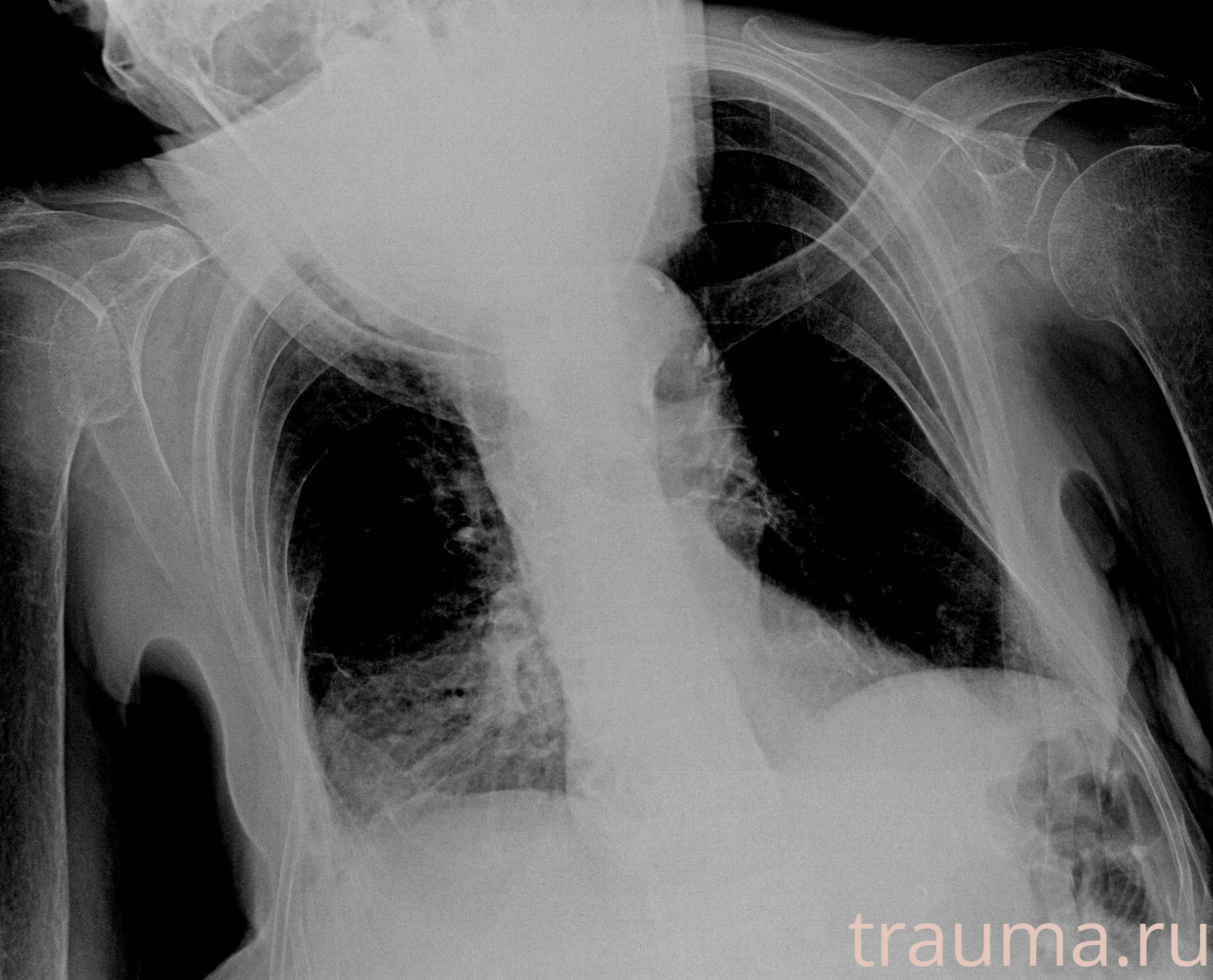 Рентген на дому: по вашему адресу приезжает врач-рентгенолог, травматолог-ортопед с мобильным рентгеновским аппаратом, проводит диагностику травмы или заболевания, делает необходимые рентгенограммы, дает рекомендации по дальнейшему лечению. Получить качественные снимки в домашних условиях возможно благодаря уникальной методике, разработанной МосРентген Центром для института  Склифосовского