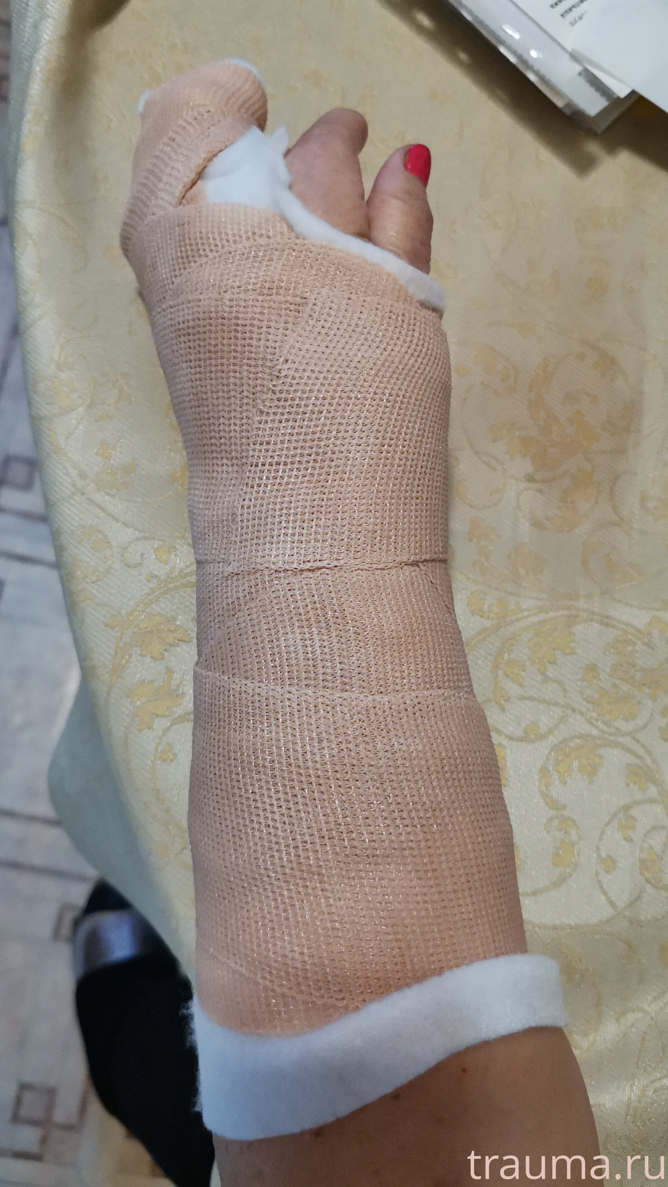 Рентген на дому: по вашему адресу приезжает врач-рентгенолог, травматолог-ортопед с мобильным рентгеновским аппаратом, проводит диагностику травмы или заболевания, делает необходимые рентгенограммы, дает рекомендации по дальнейшему лечению. Получить качественные снимки в домашних условиях возможно благодаря уникальной методике, разработанной МосРентген Центром для института  Склифосовского