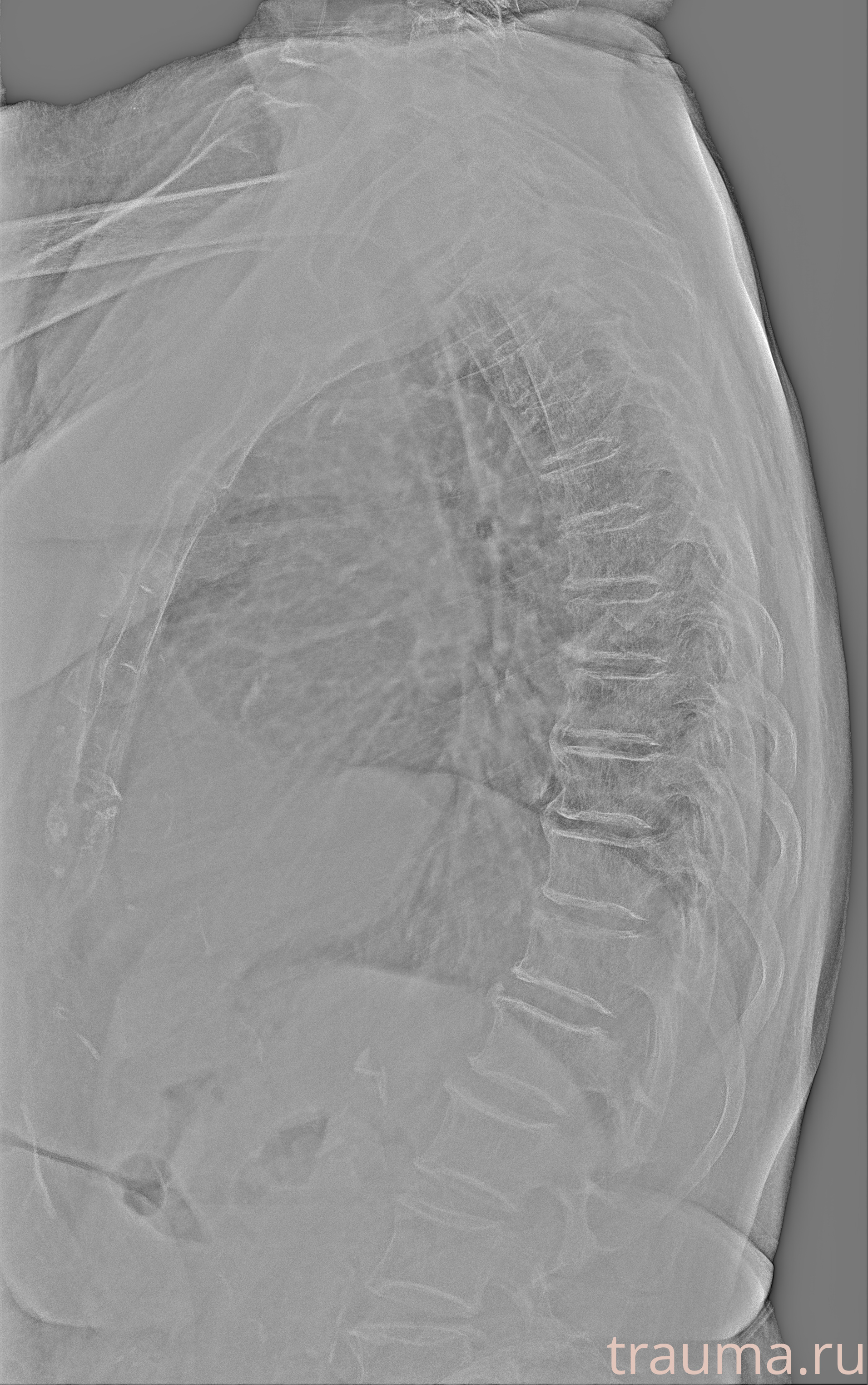 Рентген на дому: по вашему адресу приезжает врач-рентгенолог, травматолог-ортопед с мобильным рентгеновским аппаратом, проводит диагностику травмы или заболевания, делает необходимые рентгенограммы, дает рекомендации по дальнейшему лечению. Получить качественные снимки в домашних условиях возможно благодаря уникальной методике, разработанной МосРентген Центром для института  Склифосовского
