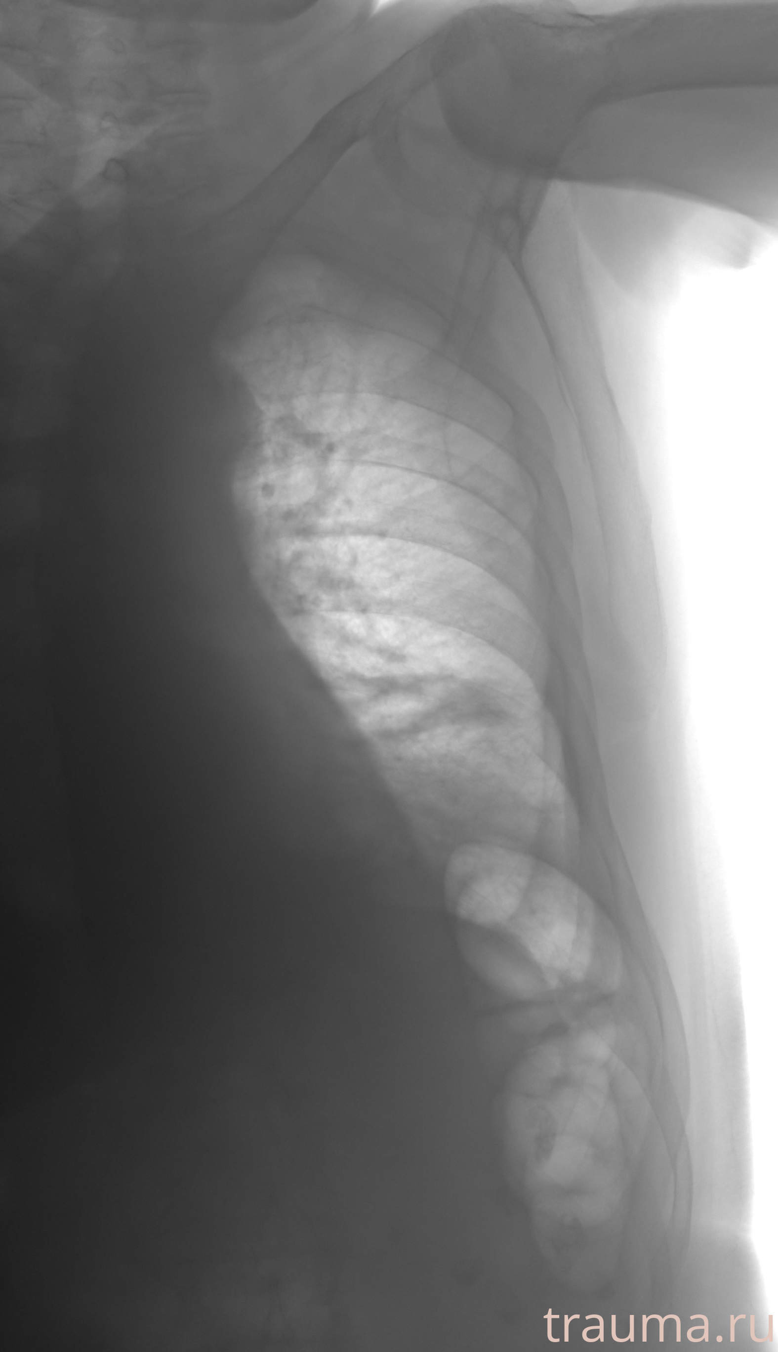 Рентген на дому: по вашему адресу приезжает врач-рентгенолог, травматолог-ортопед с мобильным рентгеновским аппаратом, проводит диагностику травмы или заболевания, делает необходимые рентгенограммы, дает рекомендации по дальнейшему лечению. Получить качественные снимки в домашних условиях возможно благодаря уникальной методике, разработанной МосРентген Центром для института  Склифосовского