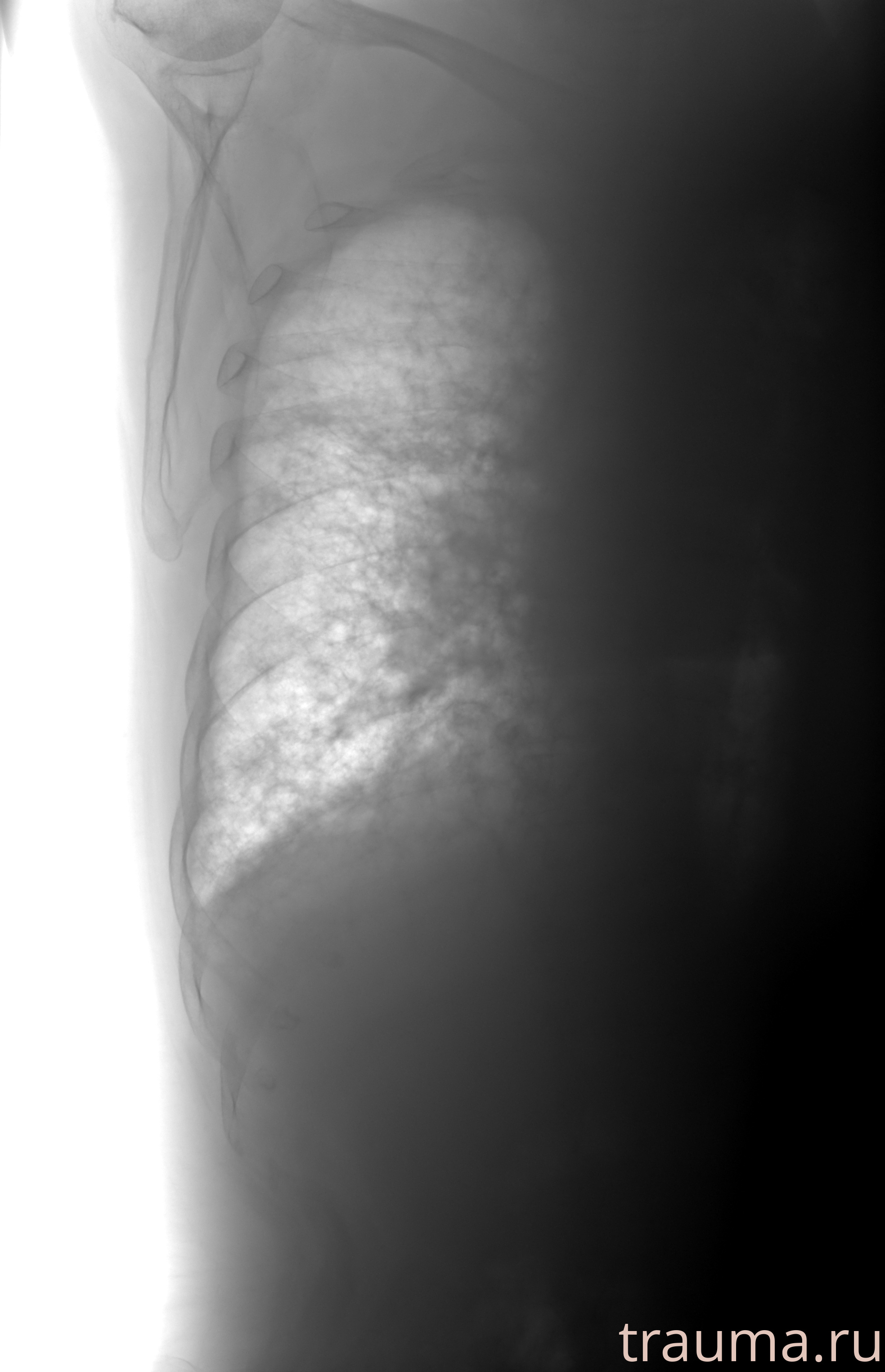 Рентген на дому: по вашему адресу приезжает врач-рентгенолог, травматолог-ортопед с мобильным рентгеновским аппаратом, проводит диагностику травмы или заболевания, делает необходимые рентгенограммы, дает рекомендации по дальнейшему лечению. Получить качественные снимки в домашних условиях возможно благодаря уникальной методике, разработанной МосРентген Центром для института  Склифосовского