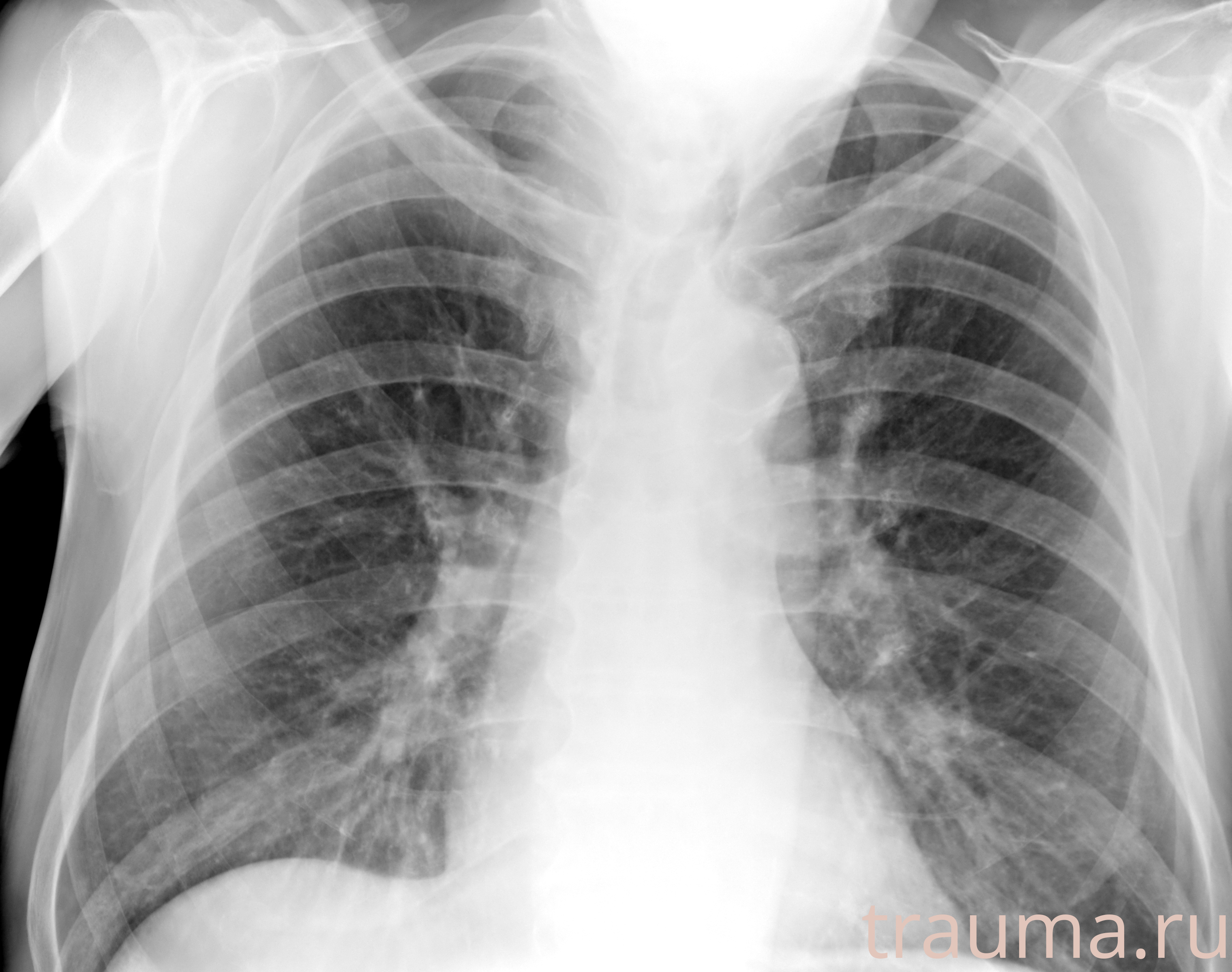 Рентген на дому: по вашему адресу приезжает врач-рентгенолог, травматолог-ортопед с мобильным рентгеновским аппаратом, проводит диагностику травмы или заболевания, делает необходимые рентгенограммы, дает рекомендации по дальнейшему лечению. Получить качественные снимки в домашних условиях возможно благодаря уникальной методике, разработанной МосРентген Центром для института  Склифосовского