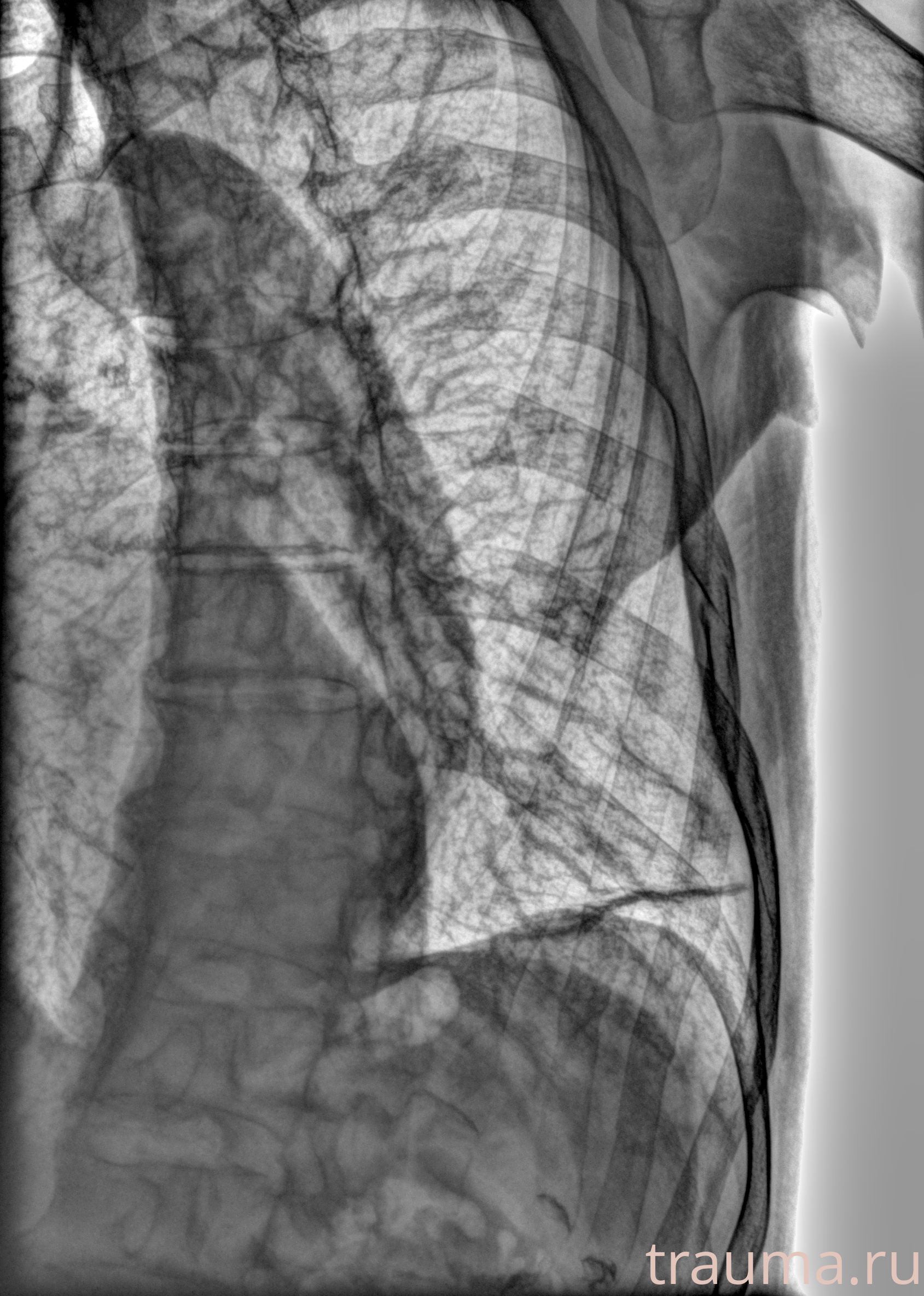 Рентген на дому: по вашему адресу приезжает врач-рентгенолог, травматолог-ортопед с мобильным рентгеновским аппаратом, проводит диагностику травмы или заболевания, делает необходимые рентгенограммы, дает рекомендации по дальнейшему лечению. Получить качественные снимки в домашних условиях возможно благодаря уникальной методике, разработанной МосРентген Центром для института  Склифосовского