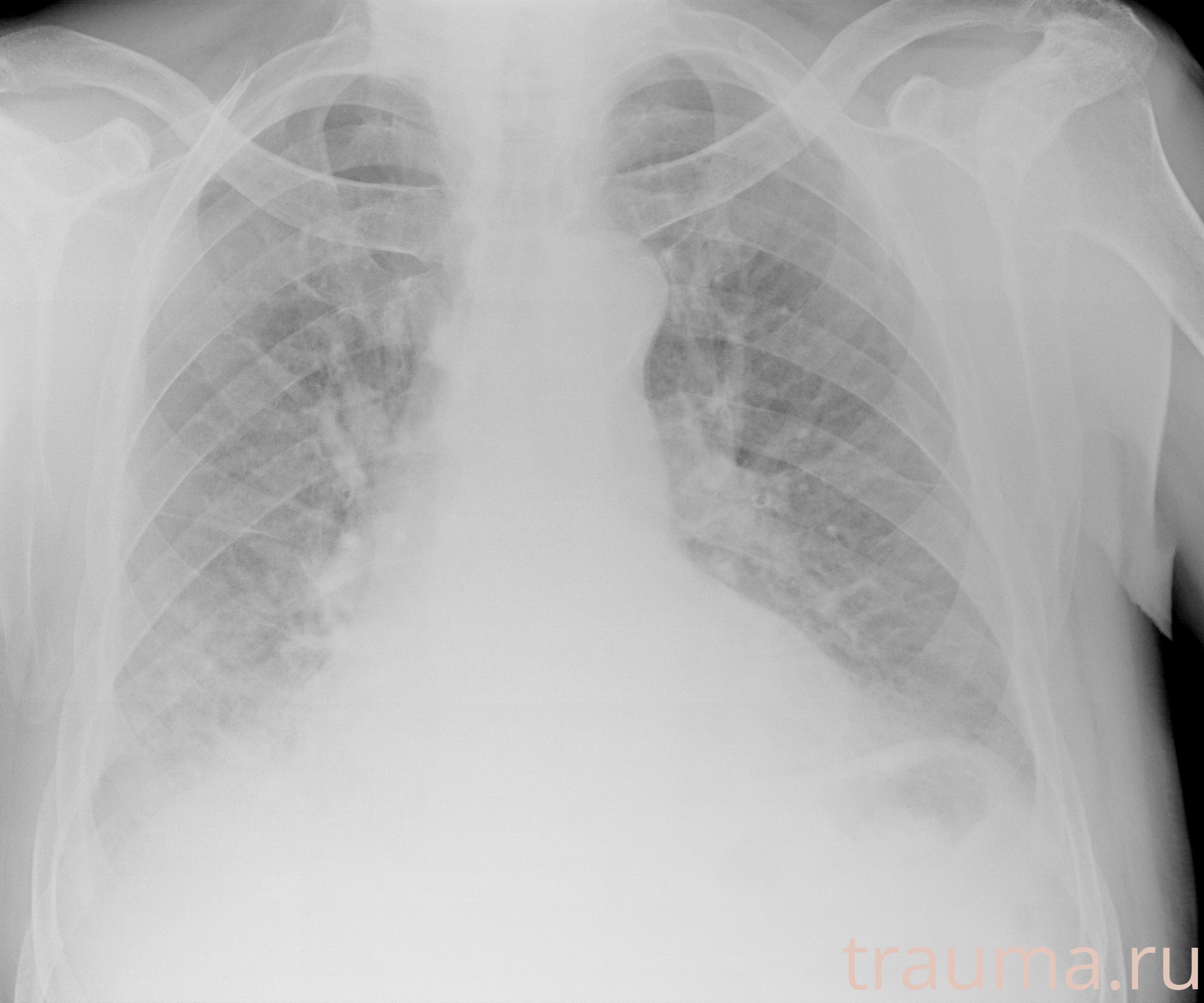 Рентген на дому: по вашему адресу приезжает врач-рентгенолог, травматолог-ортопед с мобильным рентгеновским аппаратом, проводит диагностику травмы или заболевания, делает необходимые рентгенограммы, дает рекомендации по дальнейшему лечению. Получить качественные снимки в домашних условиях возможно благодаря уникальной методике, разработанной МосРентген Центром для института  Склифосовского