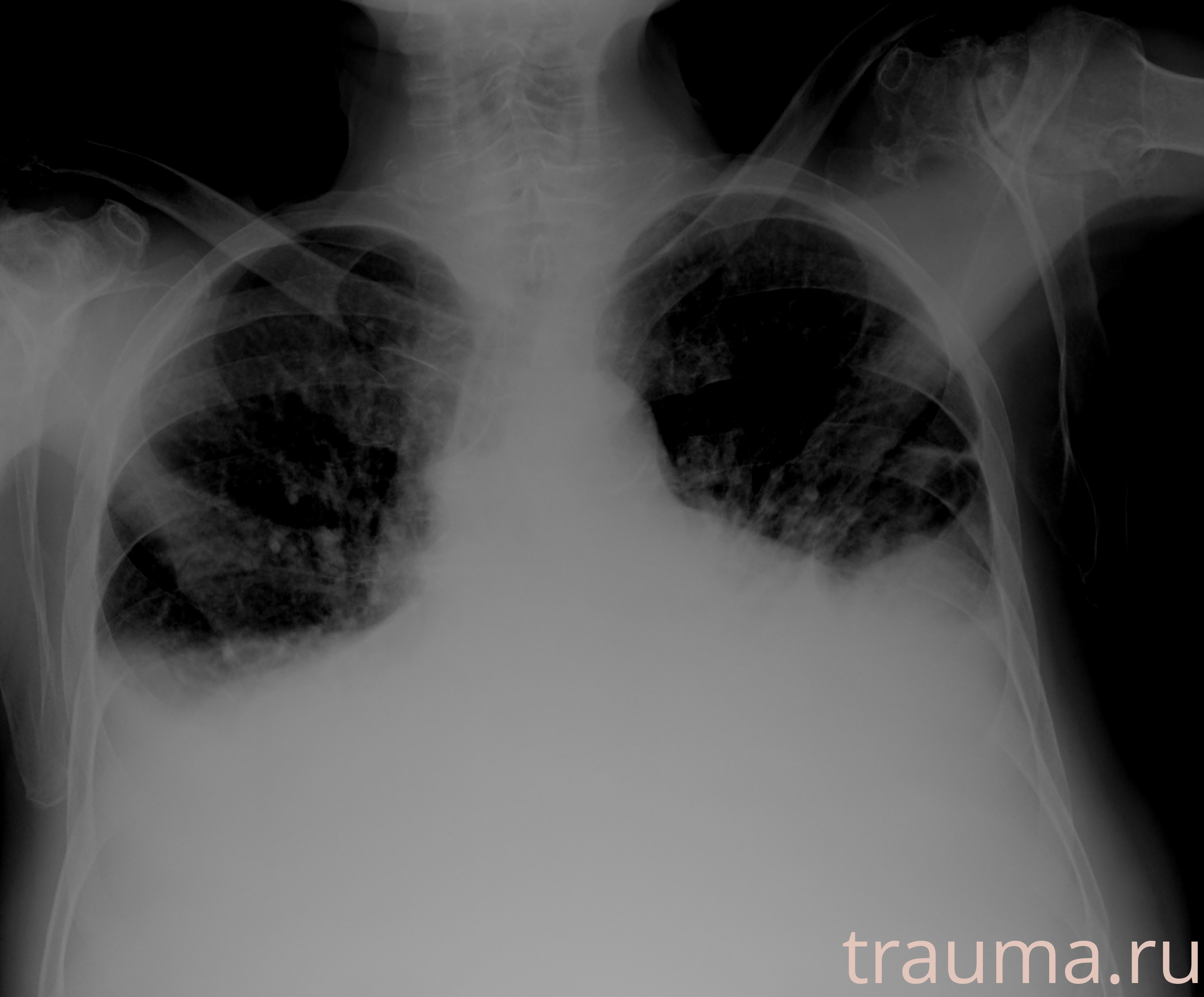 Рентген на дому: по вашему адресу приезжает врач-рентгенолог, травматолог-ортопед с мобильным рентгеновским аппаратом, проводит диагностику травмы или заболевания, делает необходимые рентгенограммы, дает рекомендации по дальнейшему лечению. Получить качественные снимки в домашних условиях возможно благодаря уникальной методике, разработанной МосРентген Центром для института  Склифосовского