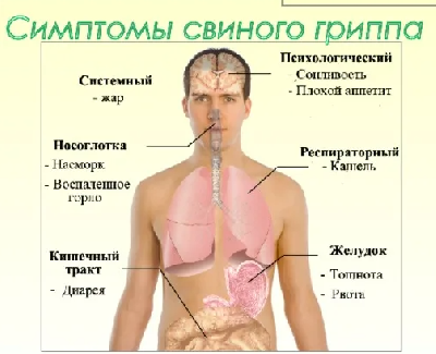 В Минздраве заявили об активном распространении свиного гриппа в России В Минздраве заявили об активном распространении свиного гриппа в России
