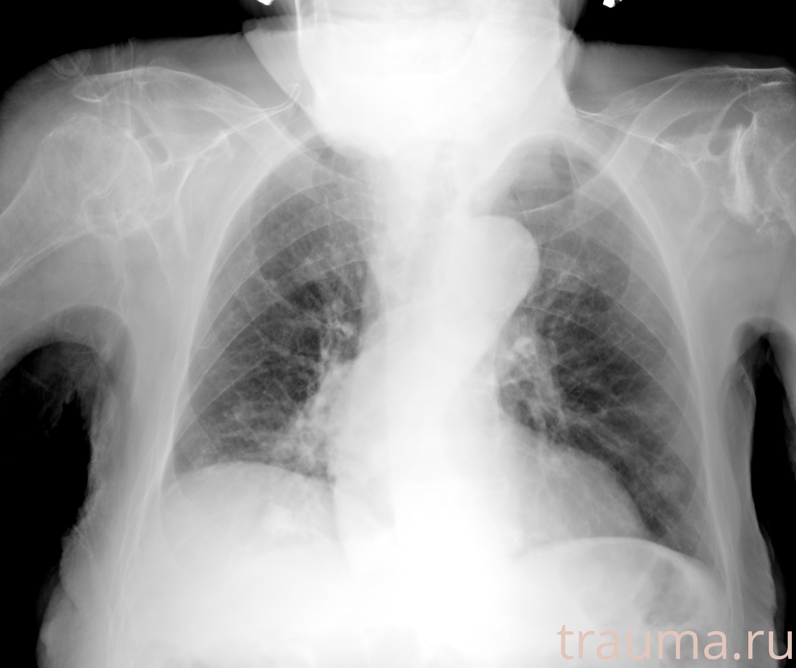 Рентген на дому: по вашему адресу приезжает врач-рентгенолог, травматолог-ортопед с мобильным рентгеновским аппаратом, проводит диагностику травмы или заболевания, делает необходимые рентгенограммы, дает рекомендации по дальнейшему лечению. Получить качественные снимки в домашних условиях возможно благодаря уникальной методике, разработанной МосРентген Центром для института  Склифосовского