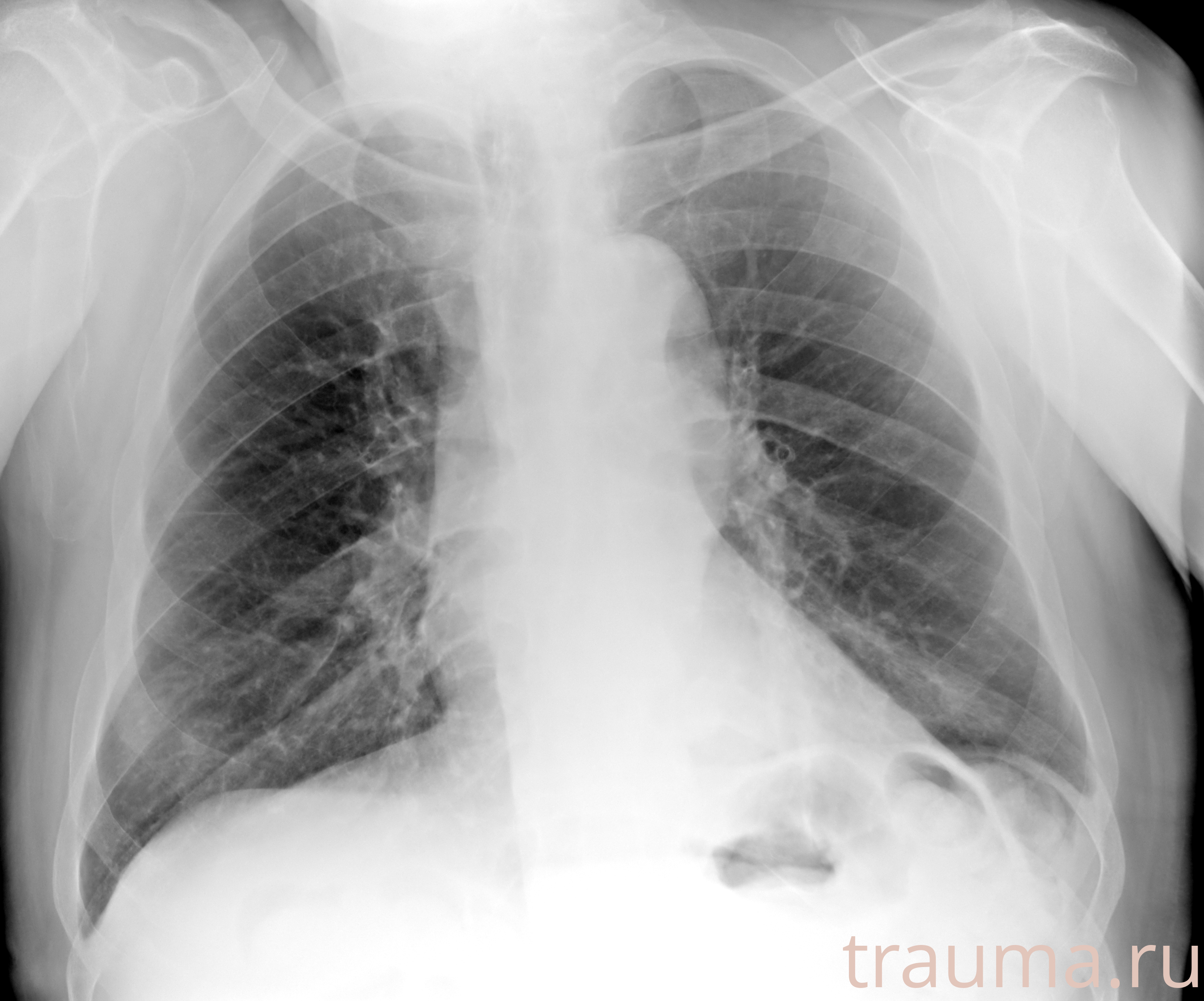 Рентген на дому: по вашему адресу приезжает врач-рентгенолог, травматолог-ортопед с мобильным рентгеновским аппаратом, проводит диагностику травмы или заболевания, делает необходимые рентгенограммы, дает рекомендации по дальнейшему лечению. Получить качественные снимки в домашних условиях возможно благодаря уникальной методике, разработанной МосРентген Центром для института  Склифосовского