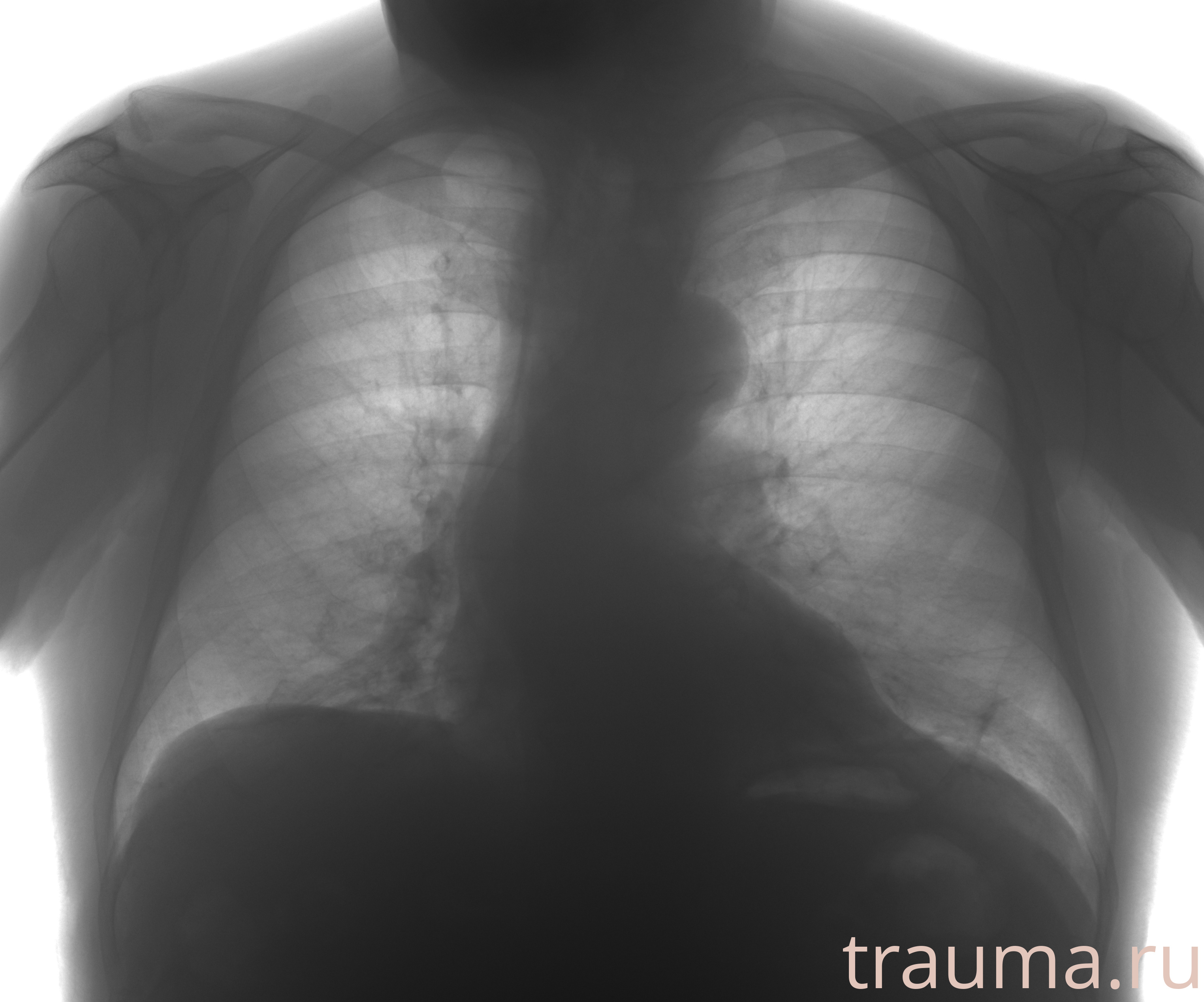 Рентген на дому: по вашему адресу приезжает врач-рентгенолог, травматолог-ортопед с мобильным рентгеновским аппаратом, проводит диагностику травмы или заболевания, делает необходимые рентгенограммы, дает рекомендации по дальнейшему лечению. Получить качественные снимки в домашних условиях возможно благодаря уникальной методике, разработанной МосРентген Центром для института  Склифосовского
