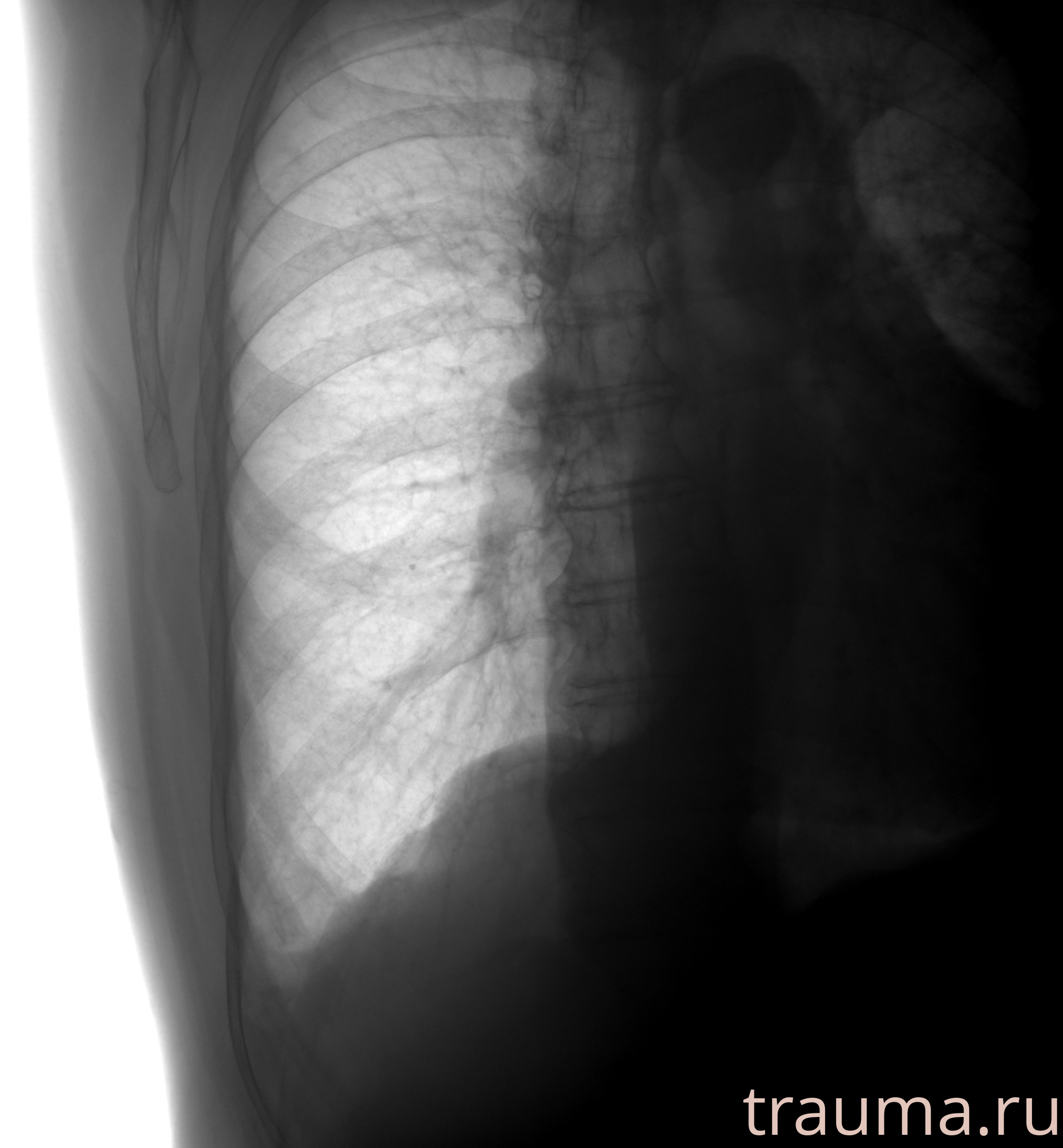 Рентген на дому: по вашему адресу приезжает врач-рентгенолог, травматолог-ортопед с мобильным рентгеновским аппаратом, проводит диагностику травмы или заболевания, делает необходимые рентгенограммы, дает рекомендации по дальнейшему лечению. Получить качественные снимки в домашних условиях возможно благодаря уникальной методике, разработанной МосРентген Центром для института  Склифосовского