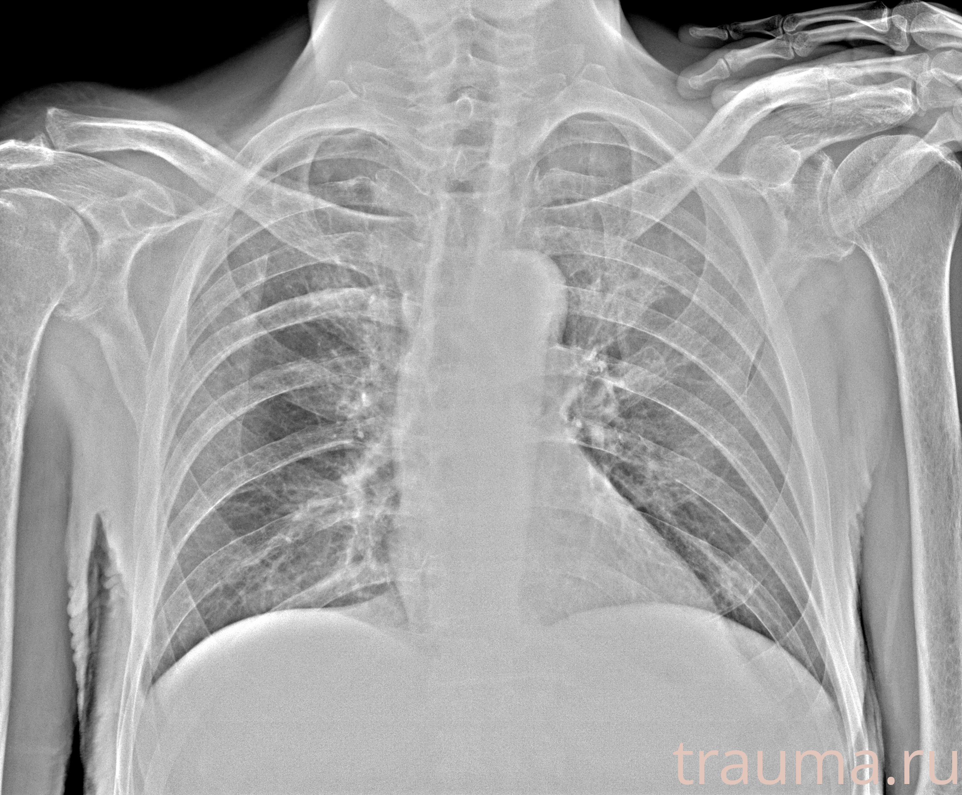 Рентген на дому: по вашему адресу приезжает врач-рентгенолог, травматолог-ортопед с мобильным рентгеновским аппаратом, проводит диагностику травмы или заболевания, делает необходимые рентгенограммы, дает рекомендации по дальнейшему лечению. Получить качественные снимки в домашних условиях возможно благодаря уникальной методике, разработанной МосРентген Центром для института  Склифосовского