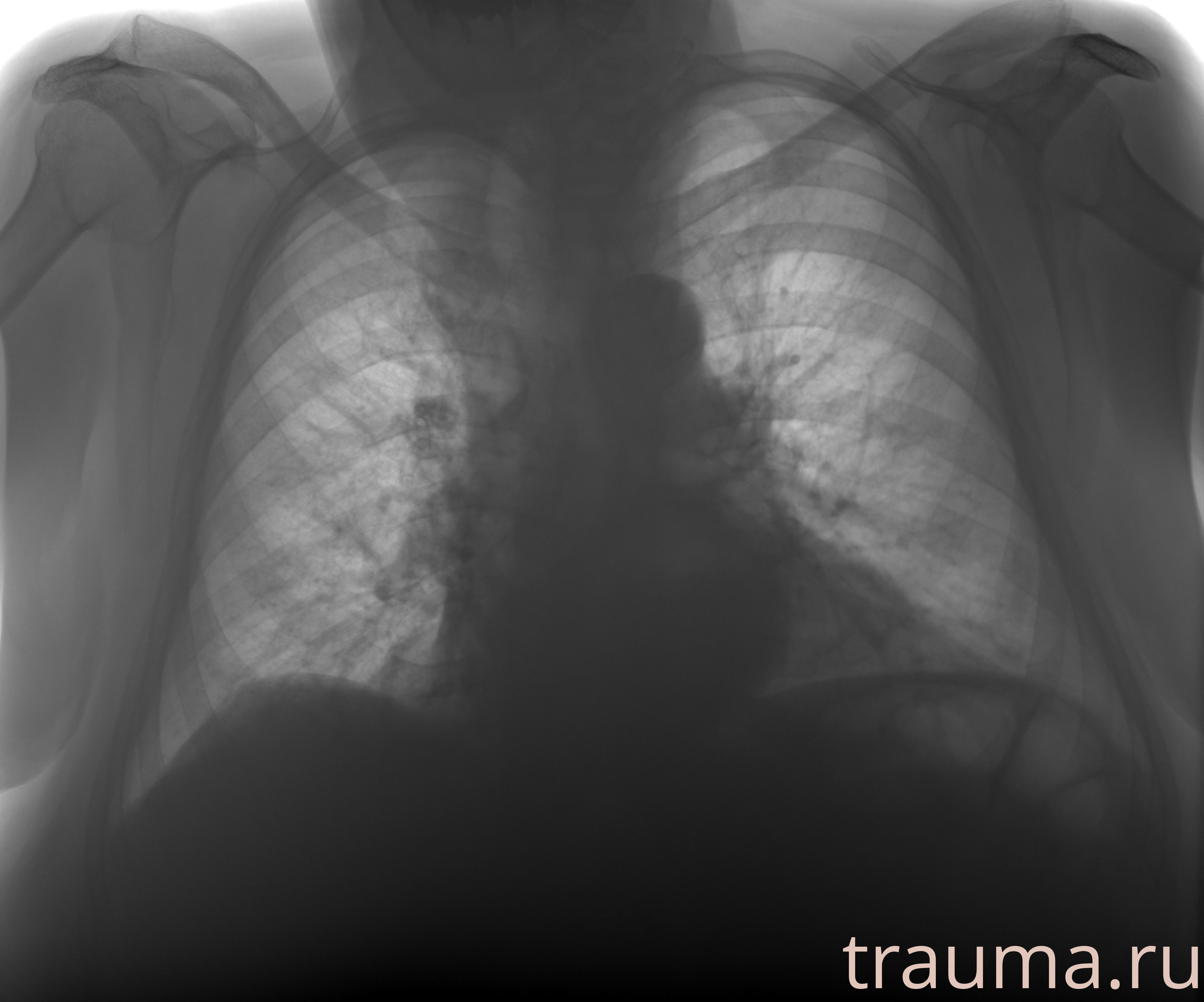 Рентген на дому: по вашему адресу приезжает врач-рентгенолог, травматолог-ортопед с мобильным рентгеновским аппаратом, проводит диагностику травмы или заболевания, делает необходимые рентгенограммы, дает рекомендации по дальнейшему лечению. Получить качественные снимки в домашних условиях возможно благодаря уникальной методике, разработанной МосРентген Центром для института  Склифосовского