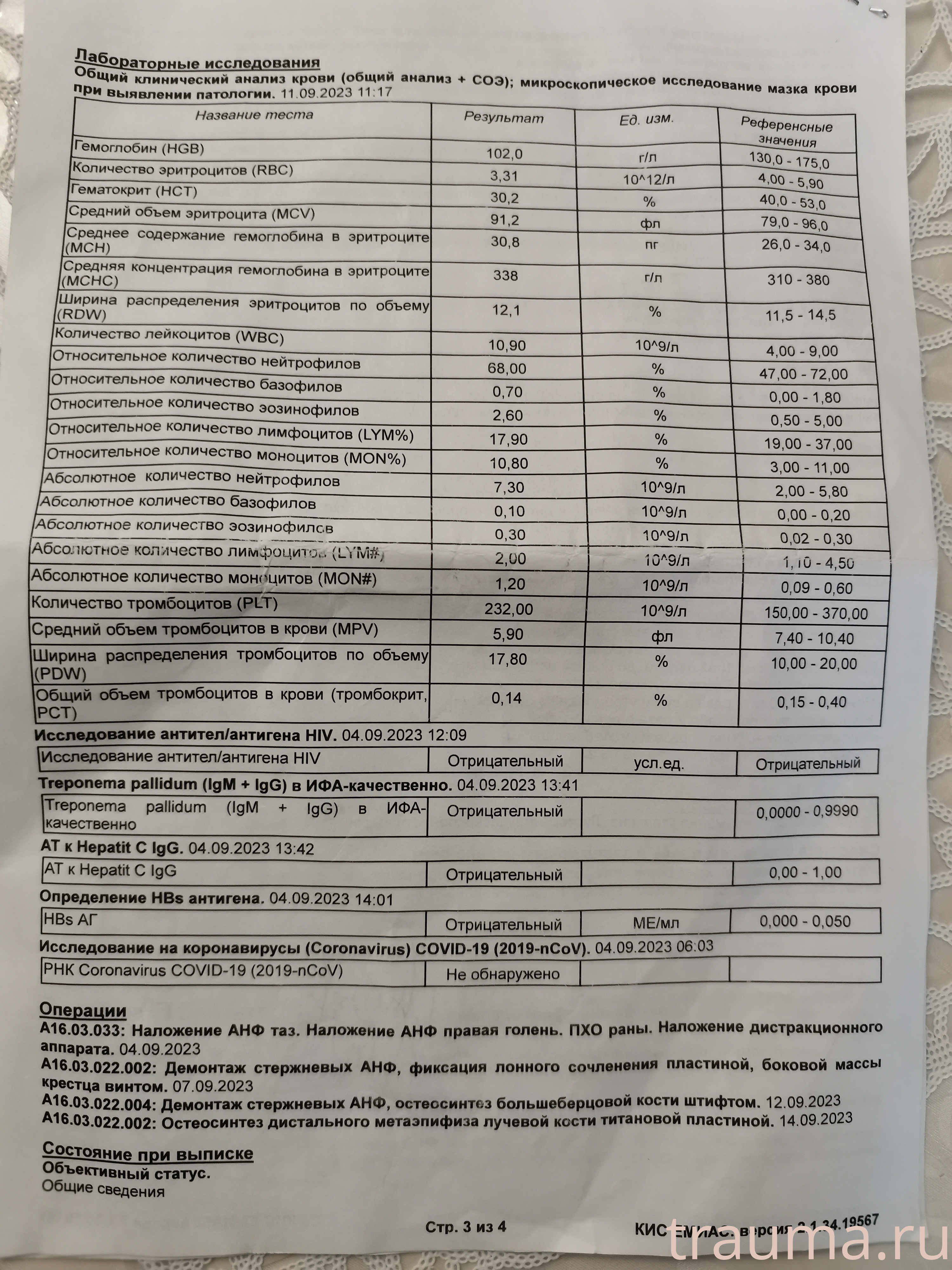 Рентген на дому: по вашему адресу приезжает врач-рентгенолог, травматолог-ортопед с мобильным рентгеновским аппаратом, проводит диагностику травмы или заболевания, делает необходимые рентгенограммы, дает рекомендации по дальнейшему лечению. Получить качественные снимки в домашних условиях возможно благодаря уникальной методике, разработанной МосРентген Центром для института  Склифосовского