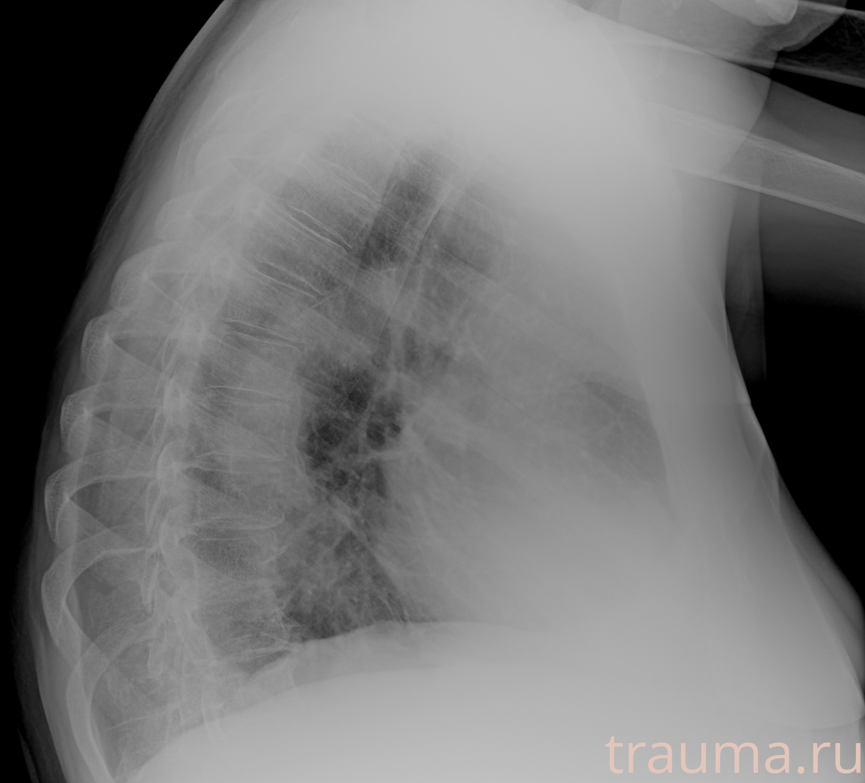 Рентген на дому: по вашему адресу приезжает врач-рентгенолог, травматолог-ортопед с мобильным рентгеновским аппаратом, проводит диагностику травмы или заболевания, делает необходимые рентгенограммы, дает рекомендации по дальнейшему лечению. Получить качественные снимки в домашних условиях возможно благодаря уникальной методике, разработанной МосРентген Центром для института  Склифосовского