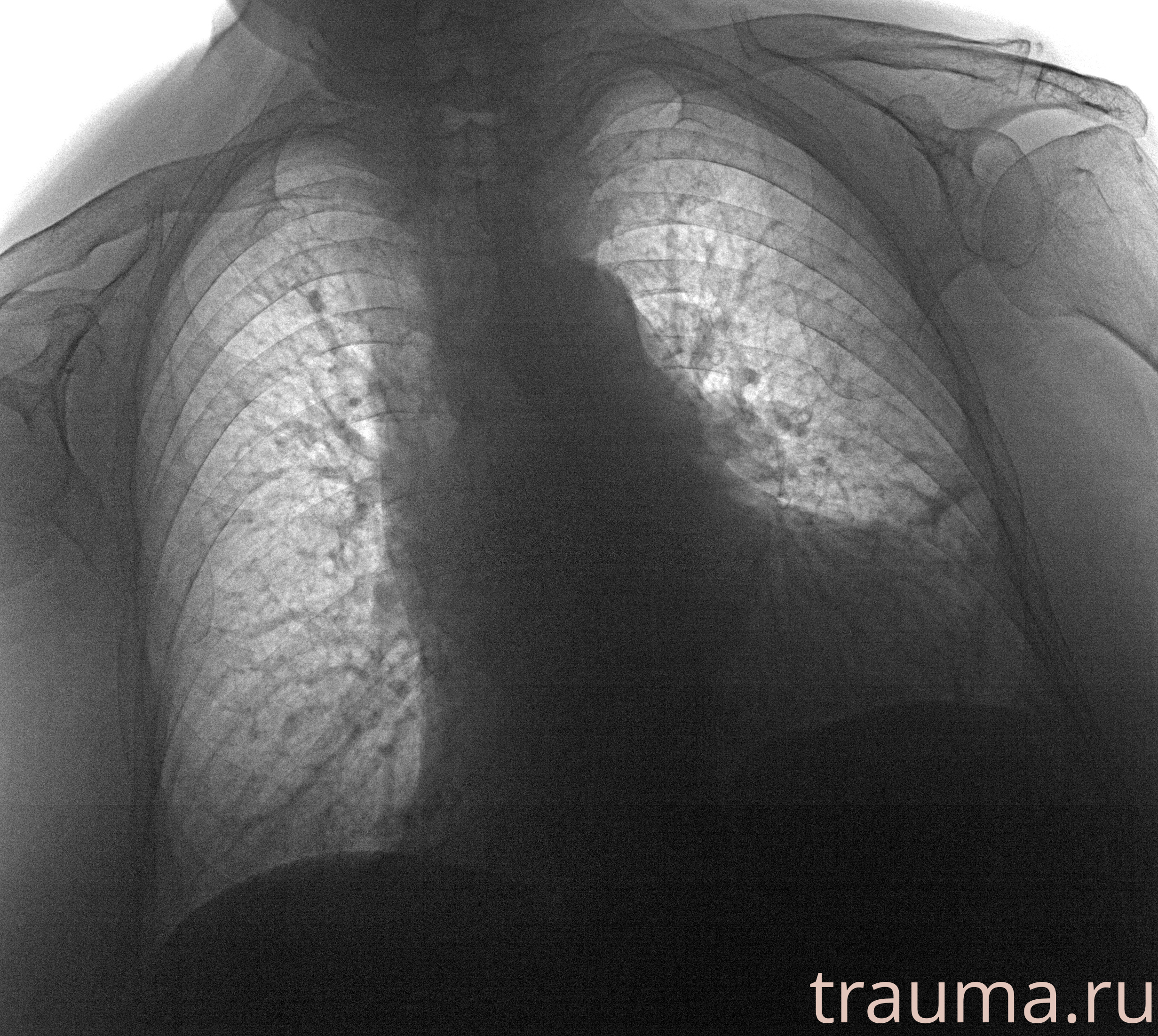 Рентген на дому: по вашему адресу приезжает врач-рентгенолог, травматолог-ортопед с мобильным рентгеновским аппаратом, проводит диагностику травмы или заболевания, делает необходимые рентгенограммы, дает рекомендации по дальнейшему лечению. Получить качественные снимки в домашних условиях возможно благодаря уникальной методике, разработанной МосРентген Центром для института  Склифосовского