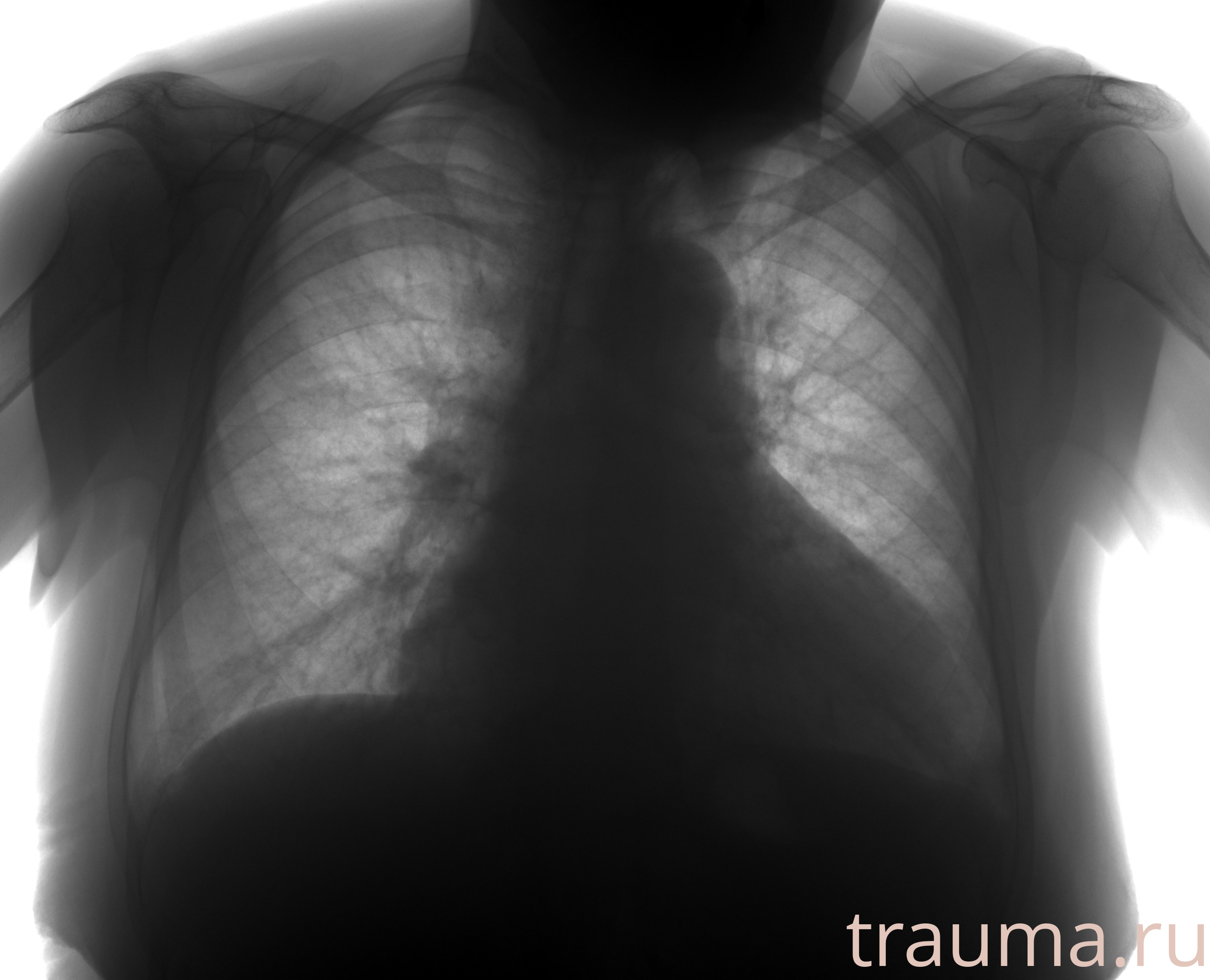 Рентген на дому: по вашему адресу приезжает врач-рентгенолог, травматолог-ортопед с мобильным рентгеновским аппаратом, проводит диагностику травмы или заболевания, делает необходимые рентгенограммы, дает рекомендации по дальнейшему лечению. Получить качественные снимки в домашних условиях возможно благодаря уникальной методике, разработанной МосРентген Центром для института  Склифосовского