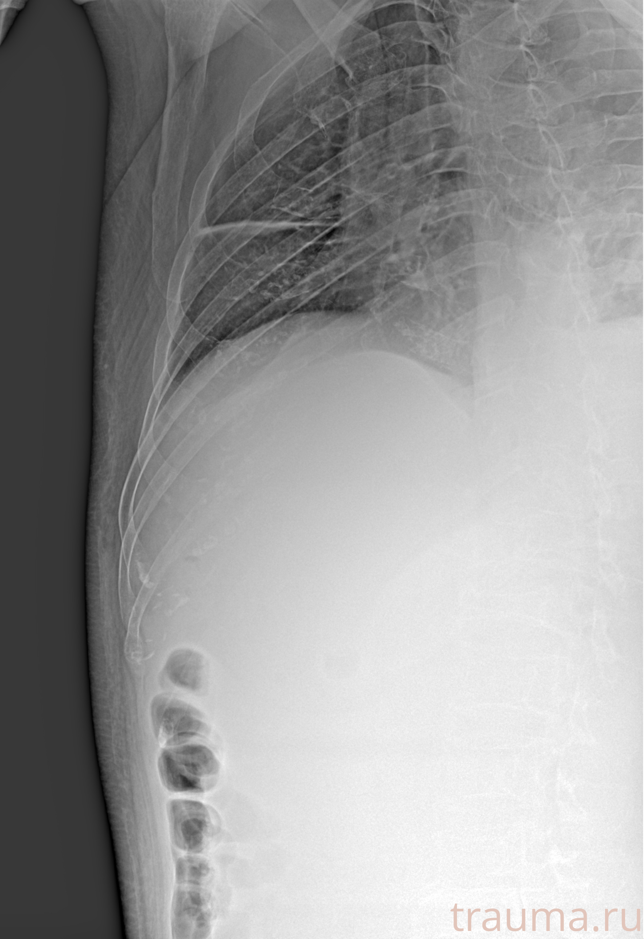 Рентген на дому: по вашему адресу приезжает врач-рентгенолог, травматолог-ортопед с мобильным рентгеновским аппаратом, проводит диагностику травмы или заболевания, делает необходимые рентгенограммы, дает рекомендации по дальнейшему лечению. Получить качественные снимки в домашних условиях возможно благодаря уникальной методике, разработанной МосРентген Центром для института  Склифосовского