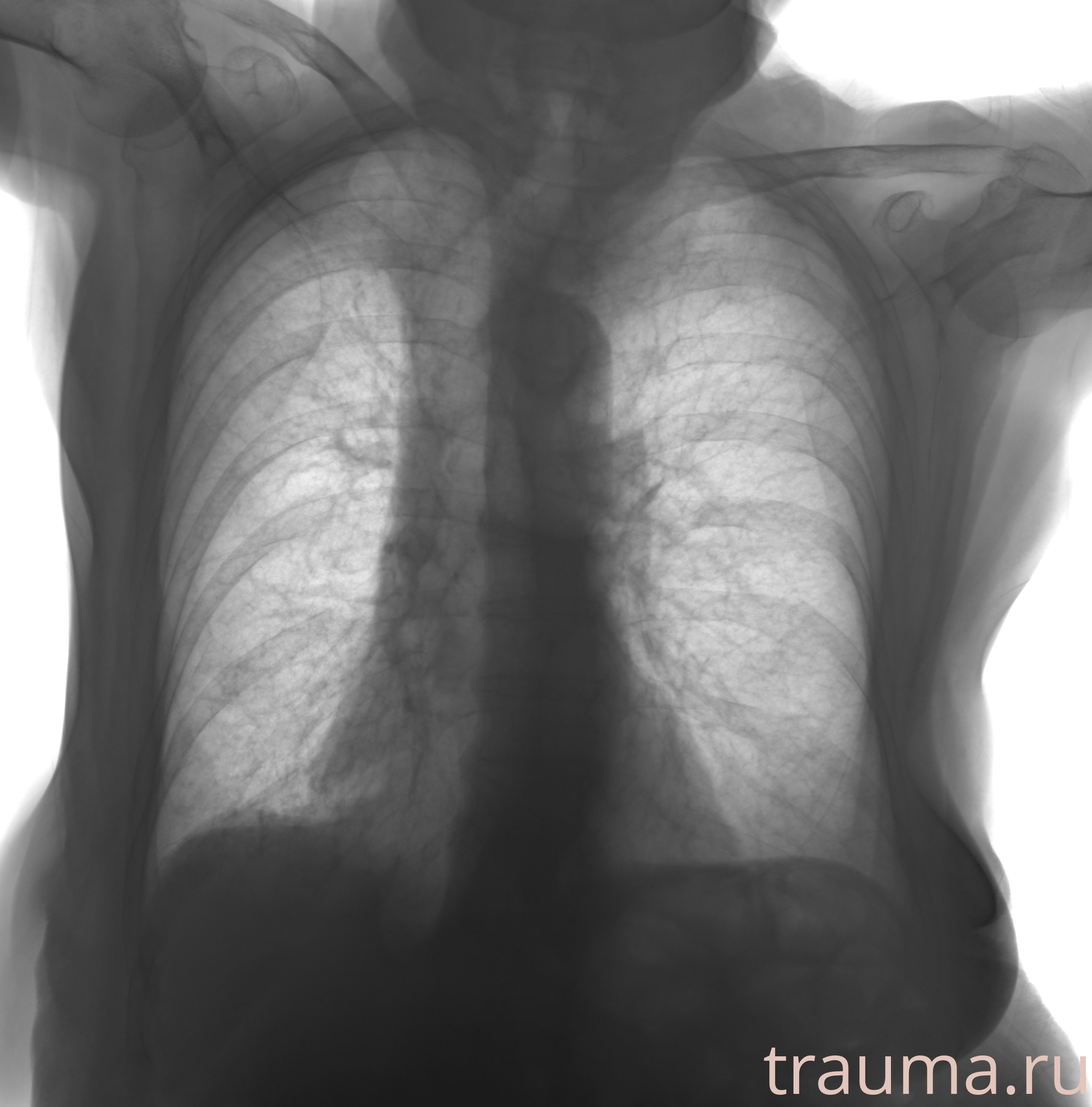 Рентген на дому: по вашему адресу приезжает врач-рентгенолог, травматолог-ортопед с мобильным рентгеновским аппаратом, проводит диагностику травмы или заболевания, делает необходимые рентгенограммы, дает рекомендации по дальнейшему лечению. Получить качественные снимки в домашних условиях возможно благодаря уникальной методике, разработанной МосРентген Центром для института  Склифосовского