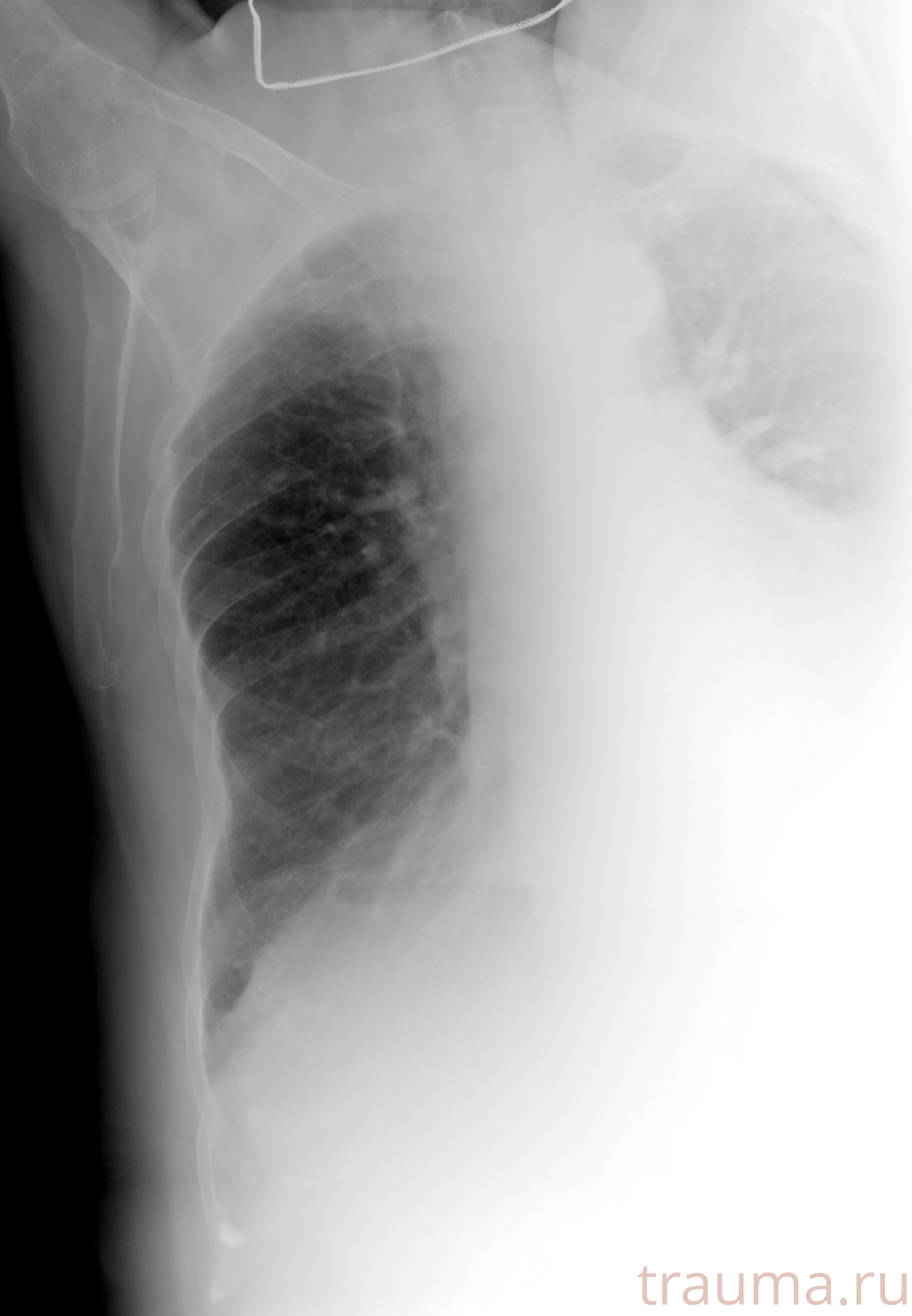 Рентген на дому: по вашему адресу приезжает врач-рентгенолог, травматолог-ортопед с мобильным рентгеновским аппаратом, проводит диагностику травмы или заболевания, делает необходимые рентгенограммы, дает рекомендации по дальнейшему лечению. Получить качественные снимки в домашних условиях возможно благодаря уникальной методике, разработанной МосРентген Центром для института  Склифосовского