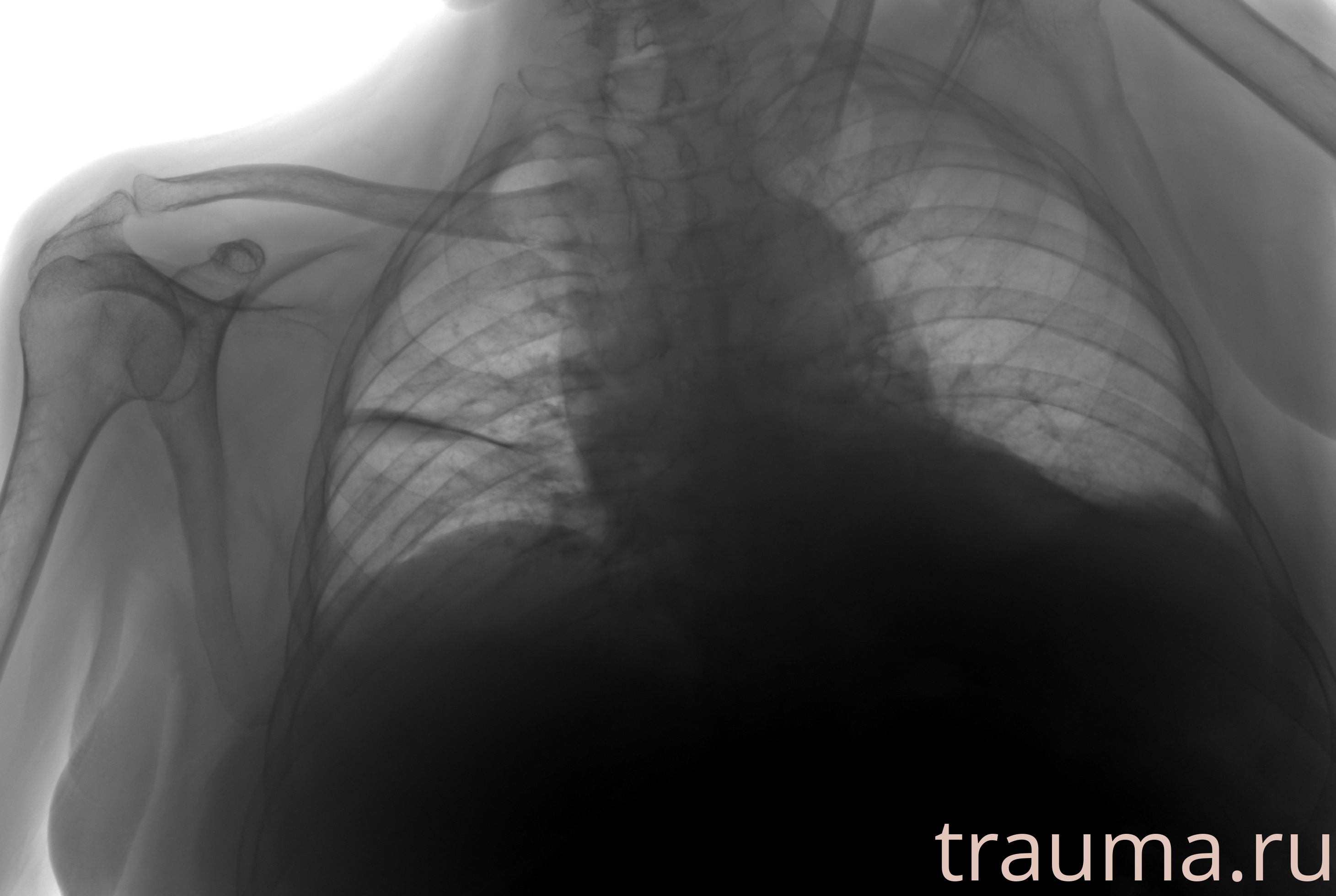 Рентген на дому: по вашему адресу приезжает врач-рентгенолог, травматолог-ортопед с мобильным рентгеновским аппаратом, проводит диагностику травмы или заболевания, делает необходимые рентгенограммы, дает рекомендации по дальнейшему лечению. Получить качественные снимки в домашних условиях возможно благодаря уникальной методике, разработанной МосРентген Центром для института  Склифосовского