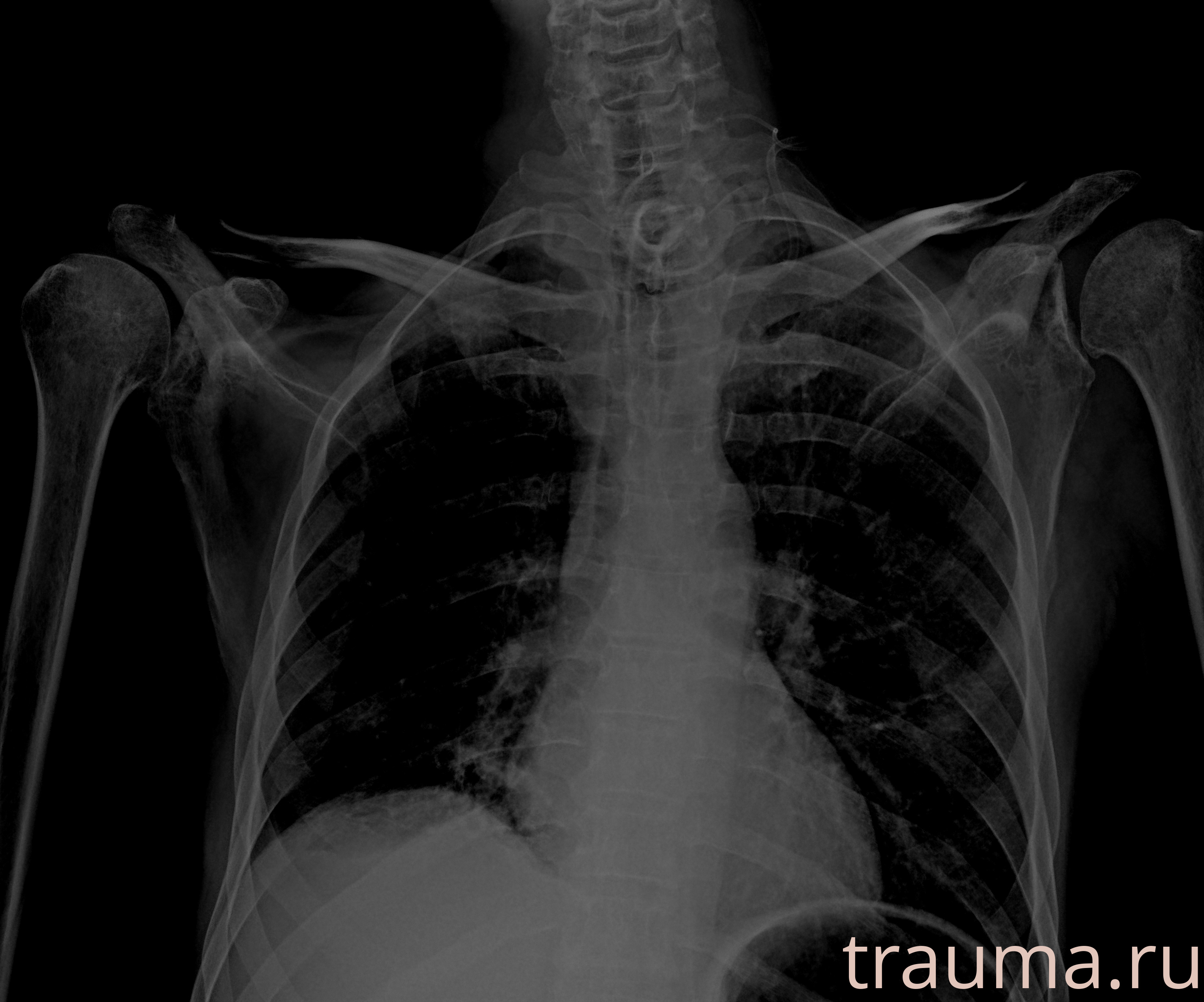 Рентген на дому: по вашему адресу приезжает врач-рентгенолог, травматолог-ортопед с мобильным рентгеновским аппаратом, проводит диагностику травмы или заболевания, делает необходимые рентгенограммы, дает рекомендации по дальнейшему лечению. Получить качественные снимки в домашних условиях возможно благодаря уникальной методике, разработанной МосРентген Центром для института  Склифосовского