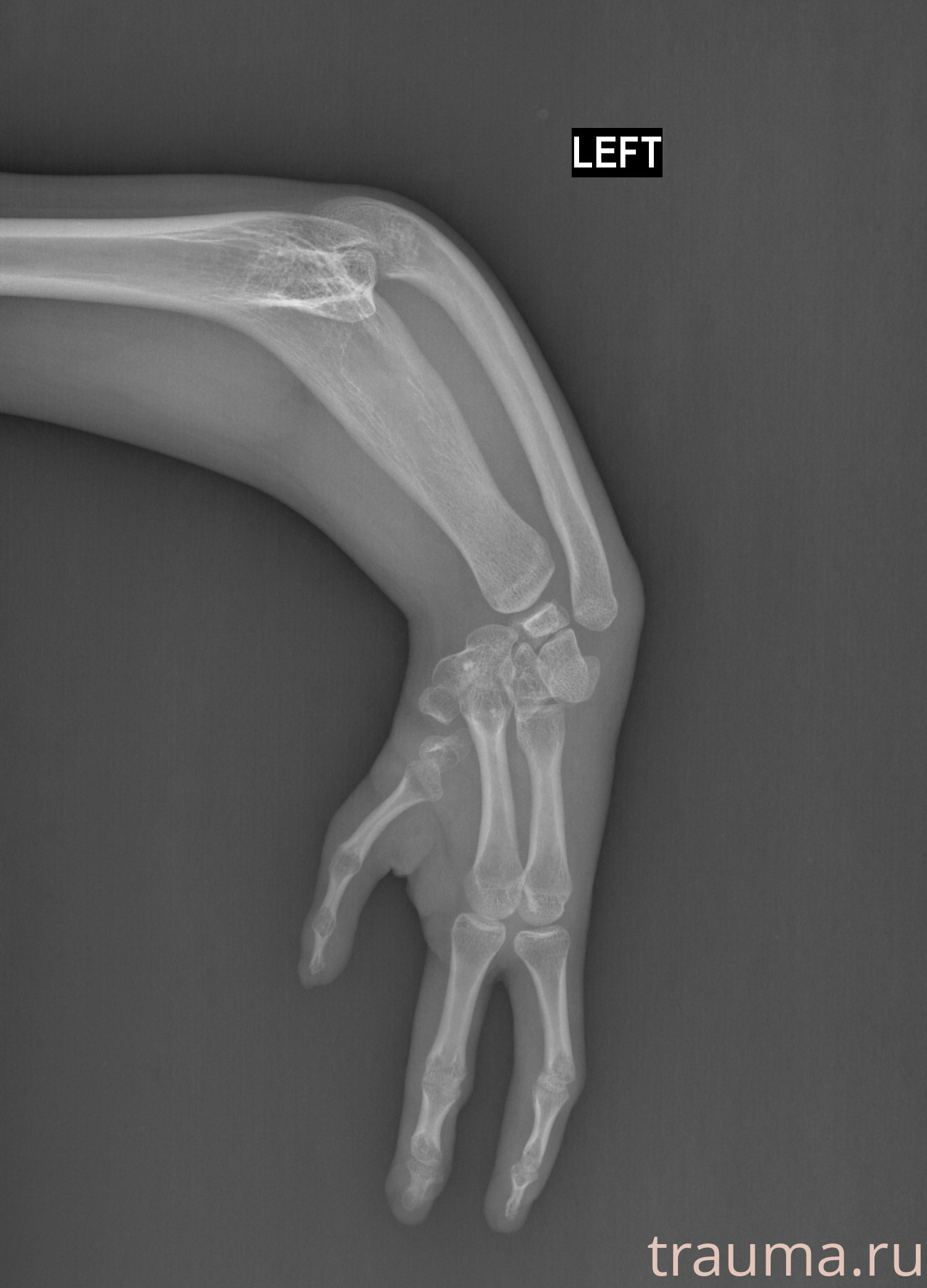 Рентген на дому: по вашему адресу приезжает врач-рентгенолог, травматолог-ортопед с мобильным рентгеновским аппаратом, проводит диагностику травмы или заболевания, делает необходимые рентгенограммы, дает рекомендации по дальнейшему лечению. Получить качественные снимки в домашних условиях возможно благодаря уникальной методике, разработанной МосРентген Центром для института  Склифосовского