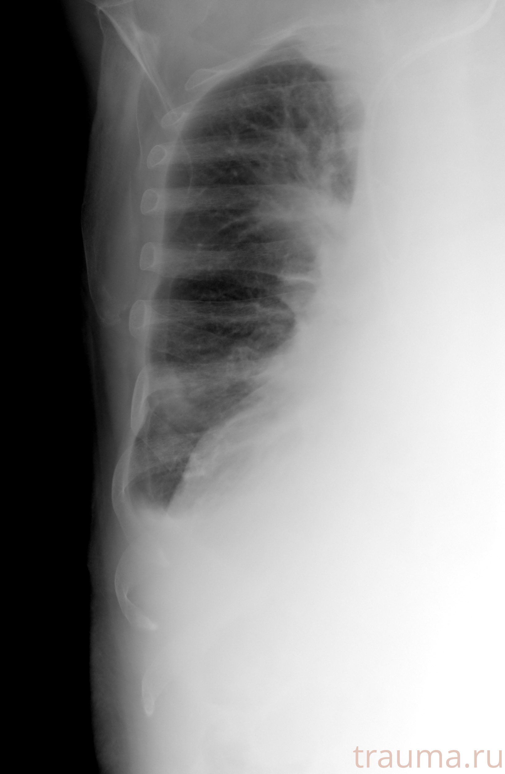 Рентген на дому: по вашему адресу приезжает врач-рентгенолог, травматолог-ортопед с мобильным рентгеновским аппаратом, проводит диагностику травмы или заболевания, делает необходимые рентгенограммы, дает рекомендации по дальнейшему лечению. Получить качественные снимки в домашних условиях возможно благодаря уникальной методике, разработанной МосРентген Центром для института  Склифосовского