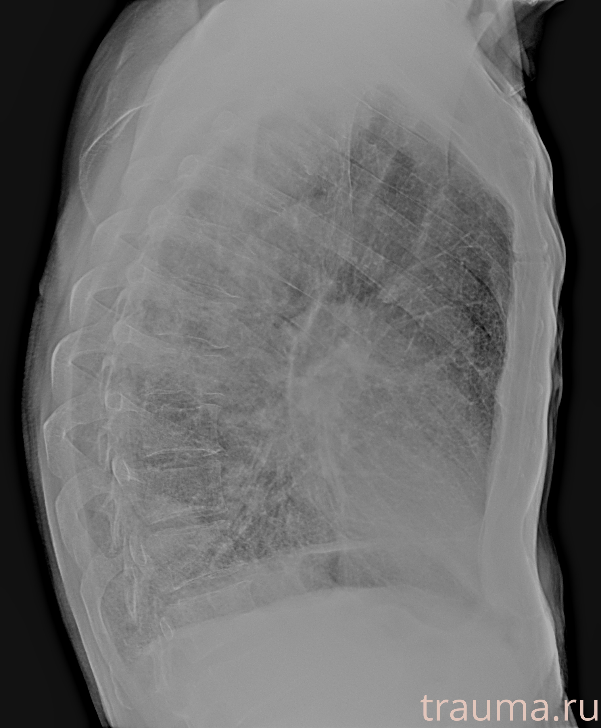 Рентген на дому: по вашему адресу приезжает врач-рентгенолог, травматолог-ортопед с мобильным рентгеновским аппаратом, проводит диагностику травмы или заболевания, делает необходимые рентгенограммы, дает рекомендации по дальнейшему лечению. Получить качественные снимки в домашних условиях возможно благодаря уникальной методике, разработанной МосРентген Центром для института  Склифосовского