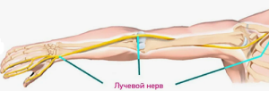 Лечение пациента с ятрогенным повреждением лучевого нерва после остеосинтеза плечевой кости: клинический случай Лечение пациента с ятрогенным повреждением лучевого нерва после остеосинтеза плечевой кости: клинический случай