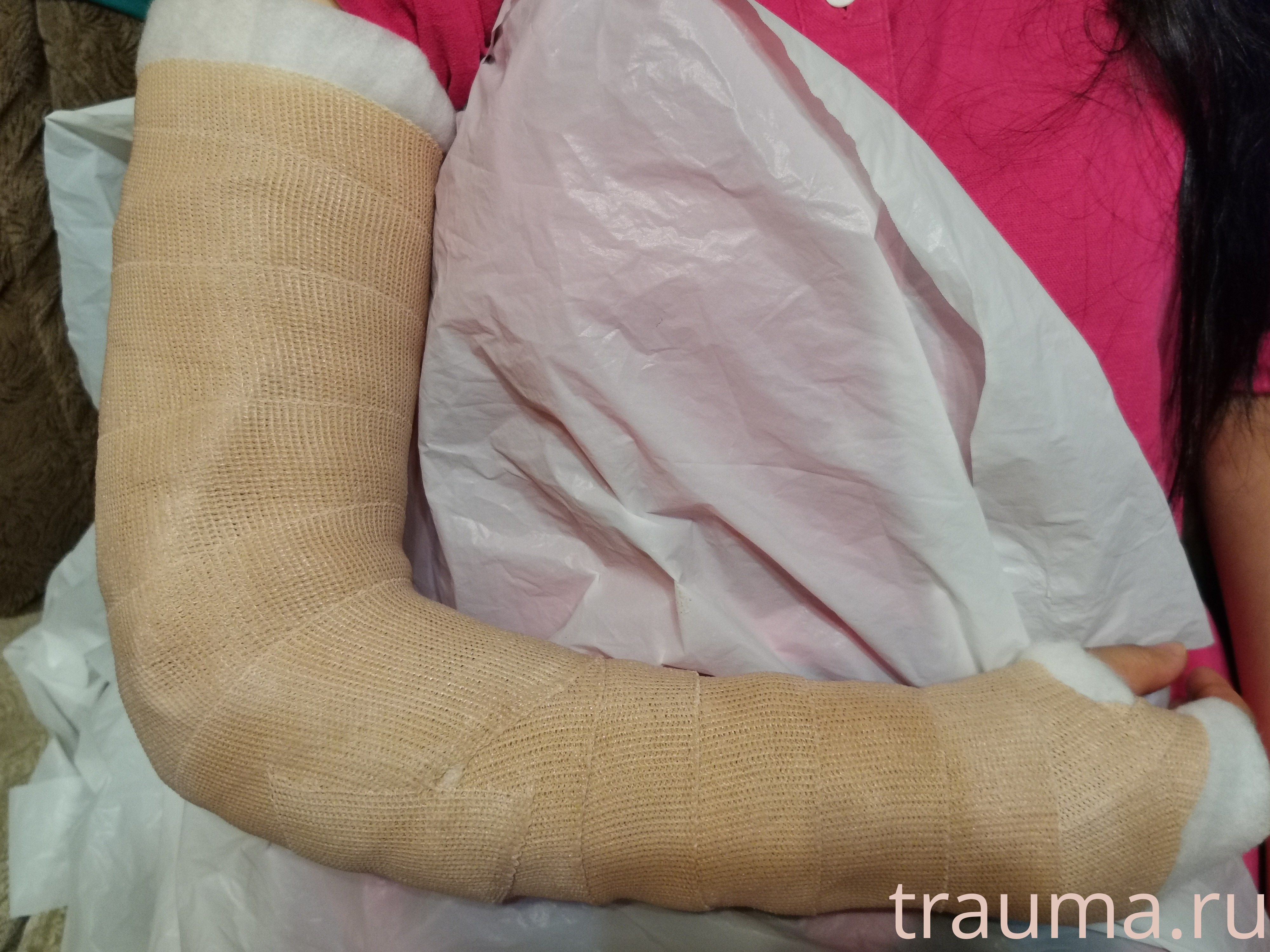 Рентген на дому: по вашему адресу приезжает врач-рентгенолог, травматолог-ортопед с мобильным рентгеновским аппаратом, проводит диагностику травмы или заболевания, делает необходимые рентгенограммы, дает рекомендации по дальнейшему лечению. Получить качественные снимки в домашних условиях возможно благодаря уникальной методике, разработанной МосРентген Центром для института  Склифосовского