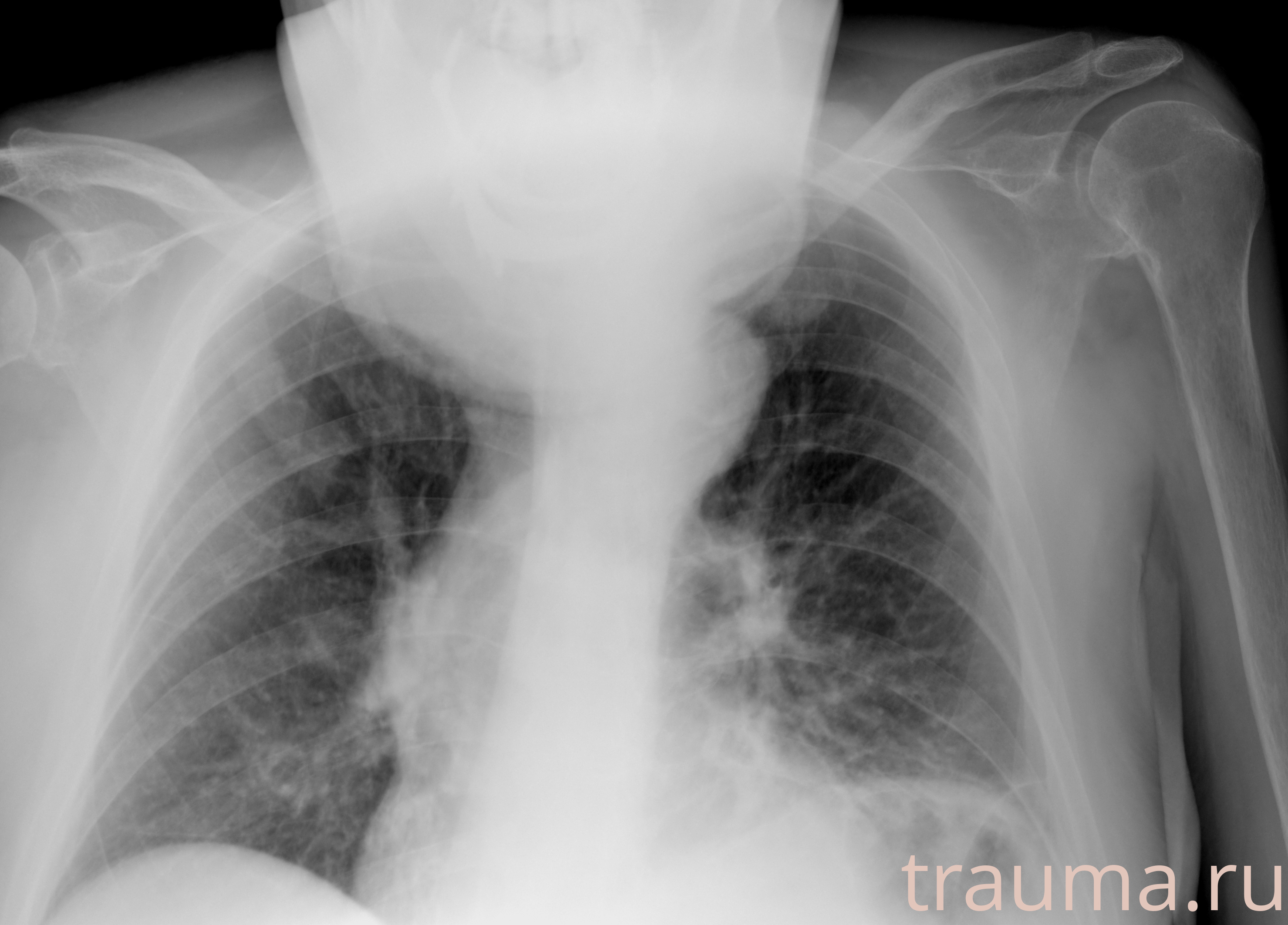 Рентген на дому: по вашему адресу приезжает врач-рентгенолог, травматолог-ортопед с мобильным рентгеновским аппаратом, проводит диагностику травмы или заболевания, делает необходимые рентгенограммы, дает рекомендации по дальнейшему лечению. Получить качественные снимки в домашних условиях возможно благодаря уникальной методике, разработанной МосРентген Центром для института  Склифосовского