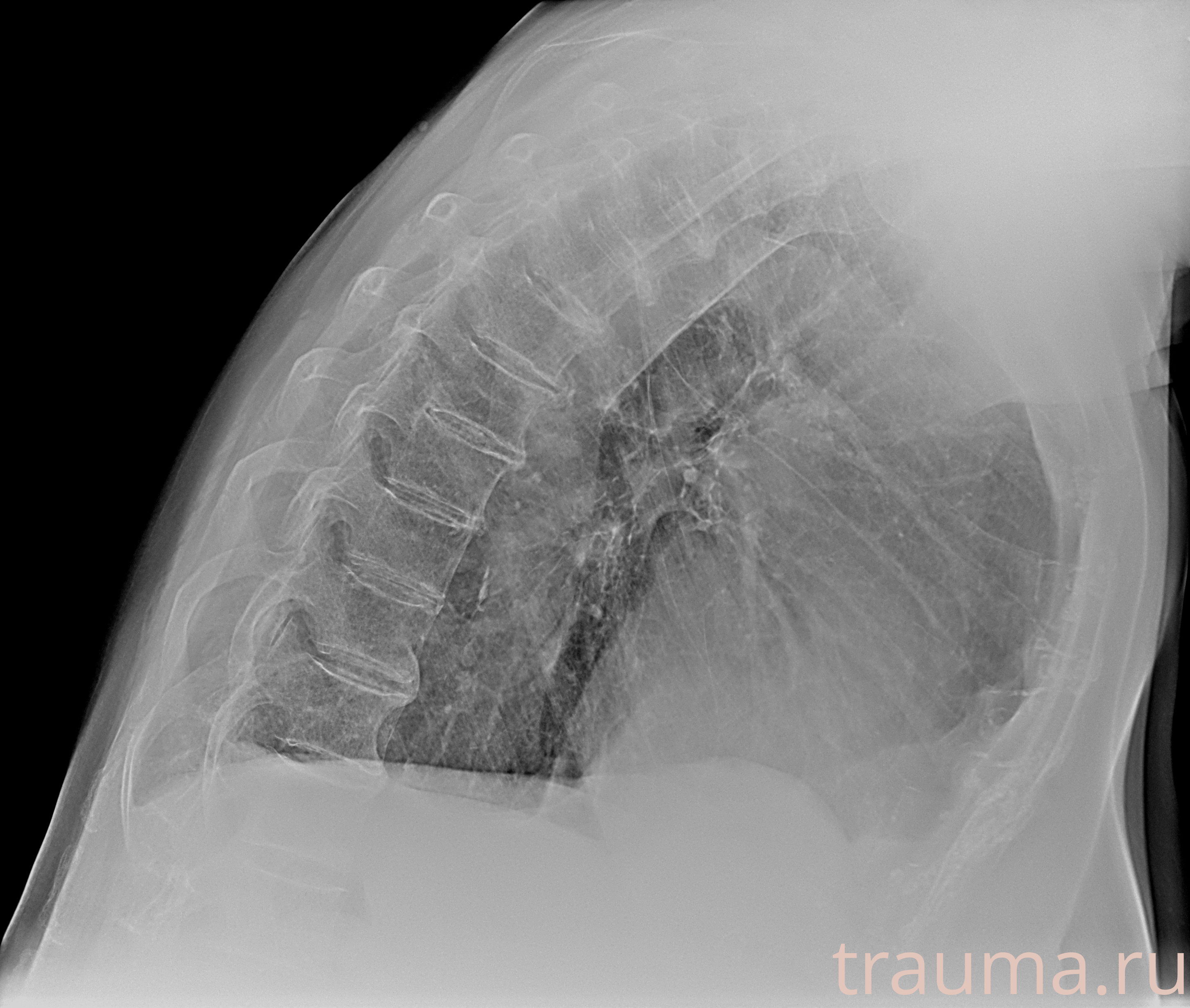 Рентген на дому: по вашему адресу приезжает врач-рентгенолог, травматолог-ортопед с мобильным рентгеновским аппаратом, проводит диагностику травмы или заболевания, делает необходимые рентгенограммы, дает рекомендации по дальнейшему лечению. Получить качественные снимки в домашних условиях возможно благодаря уникальной методике, разработанной МосРентген Центром для института  Склифосовского