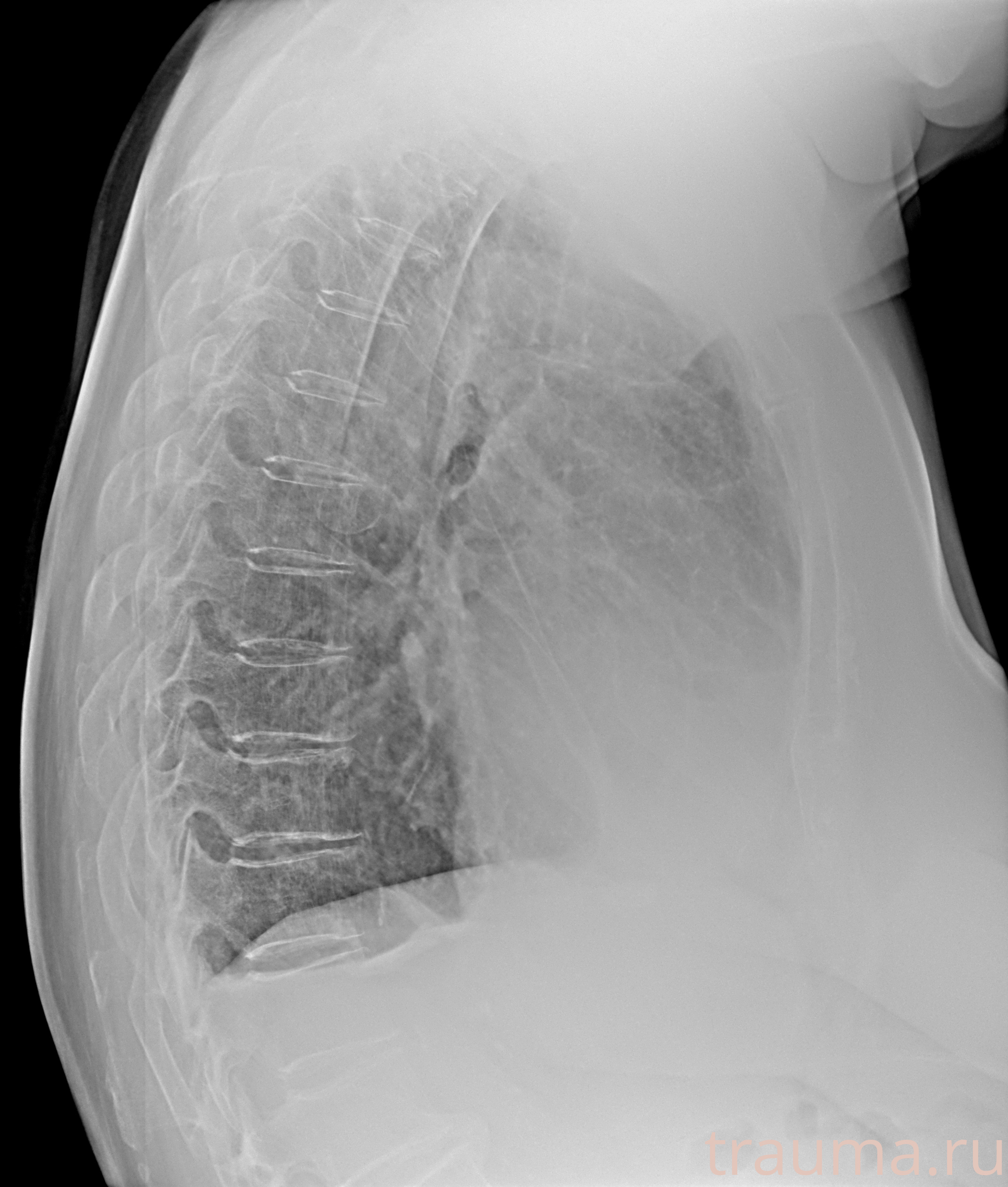 Рентген на дому: по вашему адресу приезжает врач-рентгенолог, травматолог-ортопед с мобильным рентгеновским аппаратом, проводит диагностику травмы или заболевания, делает необходимые рентгенограммы, дает рекомендации по дальнейшему лечению. Получить качественные снимки в домашних условиях возможно благодаря уникальной методике, разработанной МосРентген Центром для института  Склифосовского