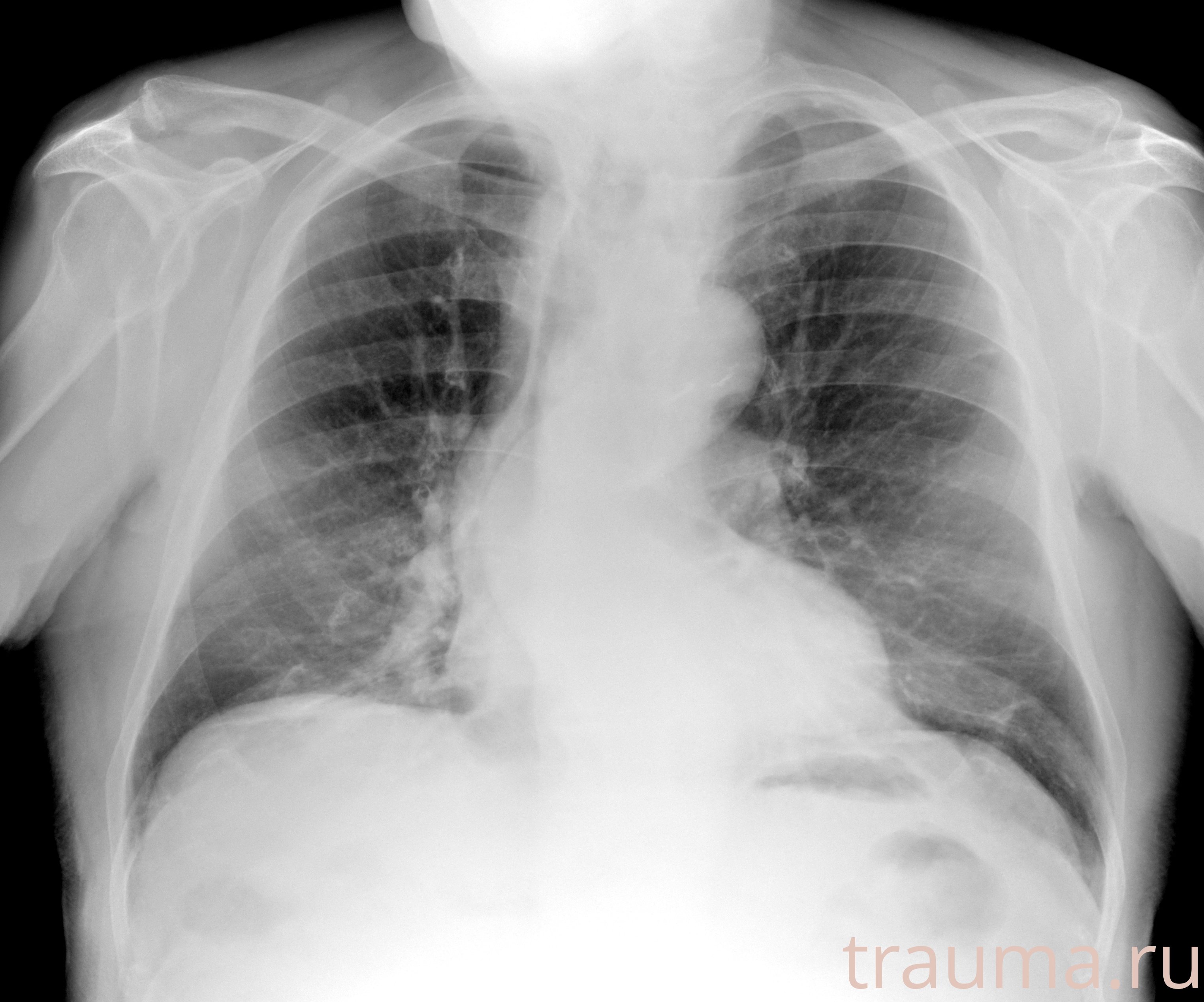 Рентген на дому: по вашему адресу приезжает врач-рентгенолог, травматолог-ортопед с мобильным рентгеновским аппаратом, проводит диагностику травмы или заболевания, делает необходимые рентгенограммы, дает рекомендации по дальнейшему лечению. Получить качественные снимки в домашних условиях возможно благодаря уникальной методике, разработанной МосРентген Центром для института  Склифосовского