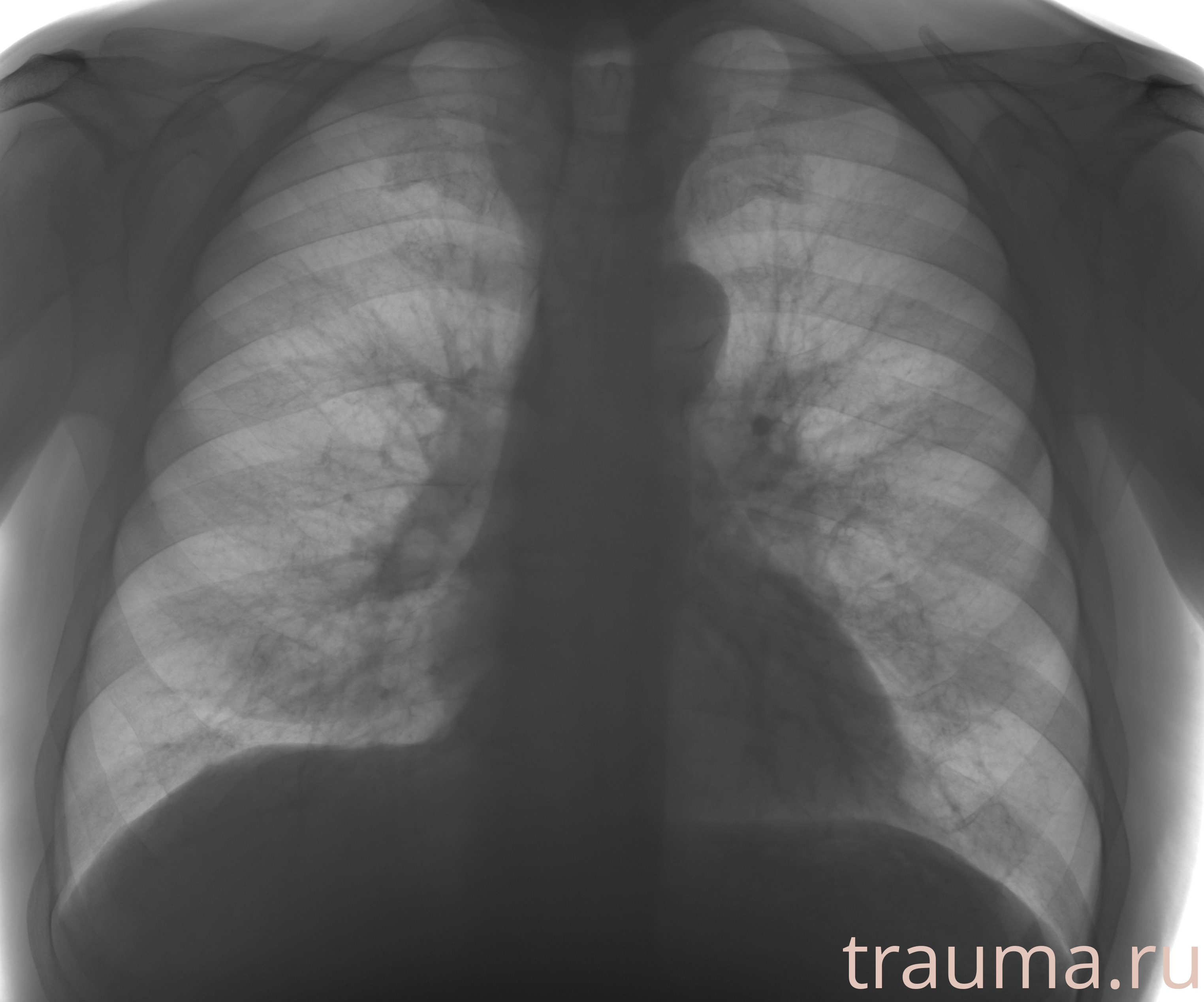 Рентген на дому: по вашему адресу приезжает врач-рентгенолог, травматолог-ортопед с мобильным рентгеновским аппаратом, проводит диагностику травмы или заболевания, делает необходимые рентгенограммы, дает рекомендации по дальнейшему лечению. Получить качественные снимки в домашних условиях возможно благодаря уникальной методике, разработанной МосРентген Центром для института  Склифосовского