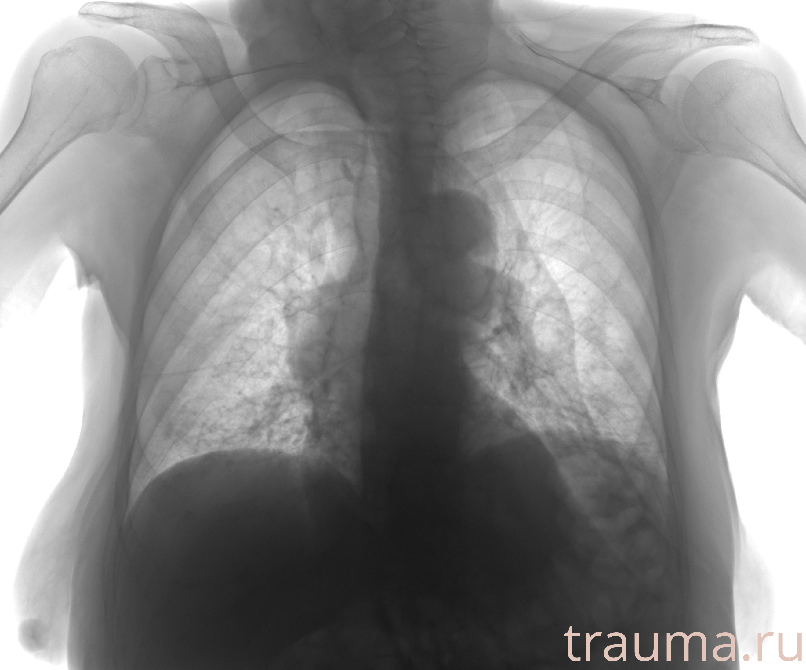 Рентген на дому: по вашему адресу приезжает врач-рентгенолог, травматолог-ортопед с мобильным рентгеновским аппаратом, проводит диагностику травмы или заболевания, делает необходимые рентгенограммы, дает рекомендации по дальнейшему лечению. Получить качественные снимки в домашних условиях возможно благодаря уникальной методике, разработанной МосРентген Центром для института  Склифосовского