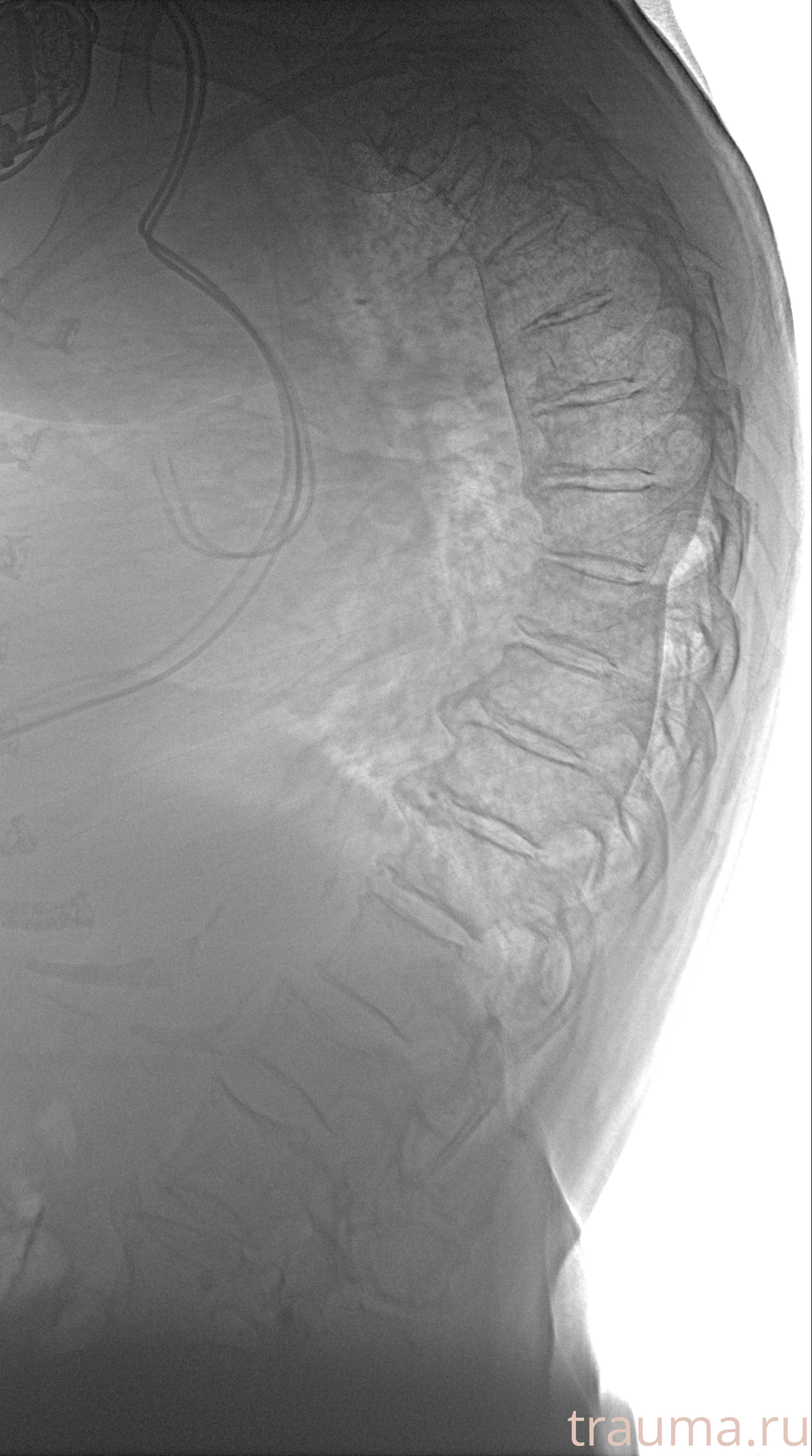 Рентген на дому: по вашему адресу приезжает врач-рентгенолог, травматолог-ортопед с мобильным рентгеновским аппаратом, проводит диагностику травмы или заболевания, делает необходимые рентгенограммы, дает рекомендации по дальнейшему лечению. Получить качественные снимки в домашних условиях возможно благодаря уникальной методике, разработанной МосРентген Центром для института  Склифосовского