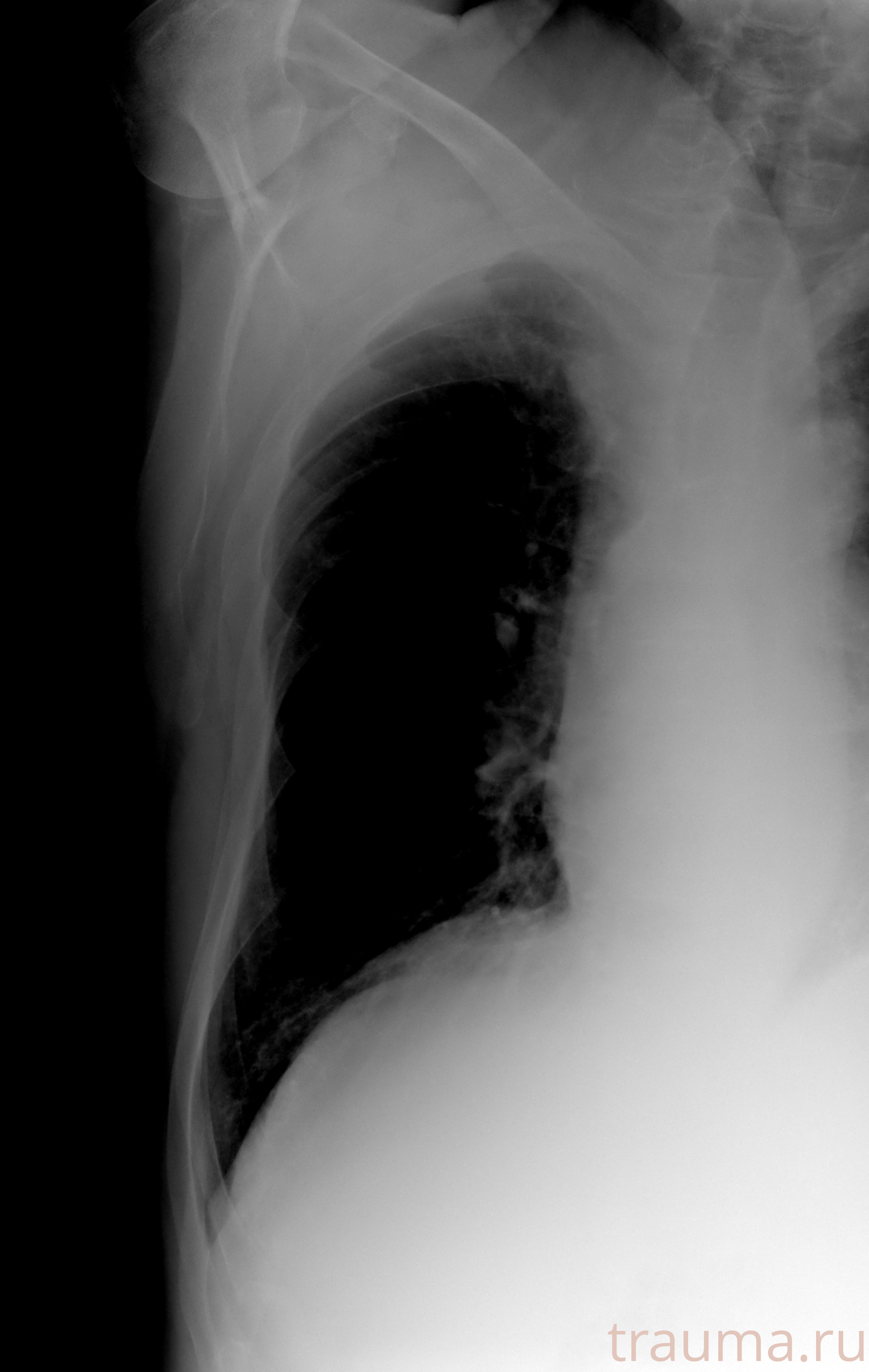 Рентген на дому: по вашему адресу приезжает врач-рентгенолог, травматолог-ортопед с мобильным рентгеновским аппаратом, проводит диагностику травмы или заболевания, делает необходимые рентгенограммы, дает рекомендации по дальнейшему лечению. Получить качественные снимки в домашних условиях возможно благодаря уникальной методике, разработанной МосРентген Центром для института  Склифосовского