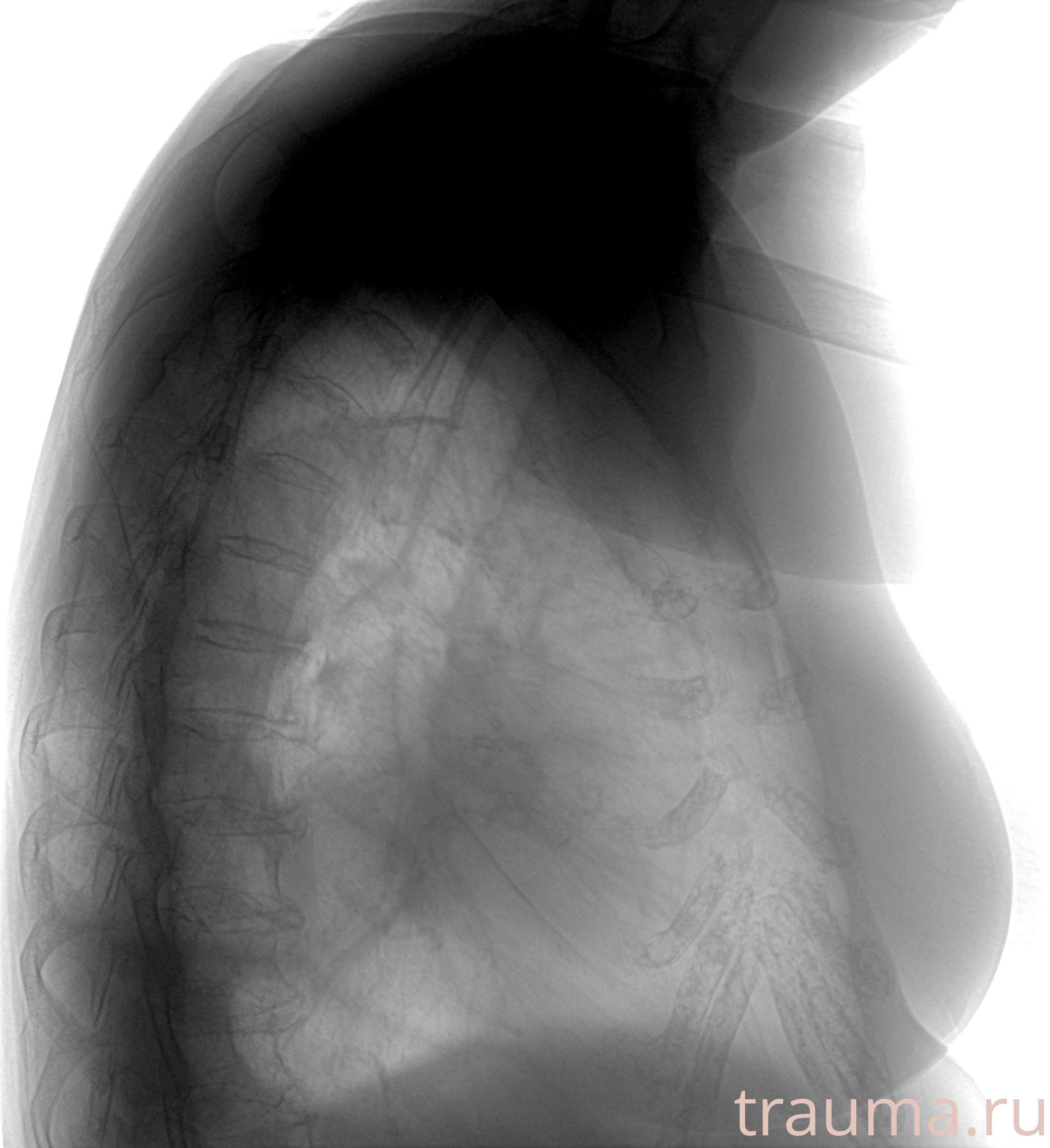 Рентген на дому: по вашему адресу приезжает врач-рентгенолог, травматолог-ортопед с мобильным рентгеновским аппаратом, проводит диагностику травмы или заболевания, делает необходимые рентгенограммы, дает рекомендации по дальнейшему лечению. Получить качественные снимки в домашних условиях возможно благодаря уникальной методике, разработанной МосРентген Центром для института  Склифосовского
