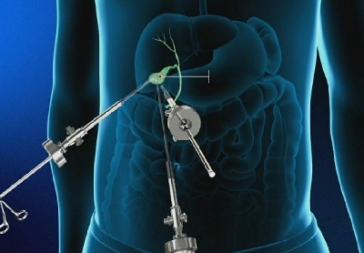 Хирургия без человека: ИИ и робот самостоятельно удалили желчный пузырь Хирургия без человека: ИИ и робот самостоятельно удалили желчный пузырь