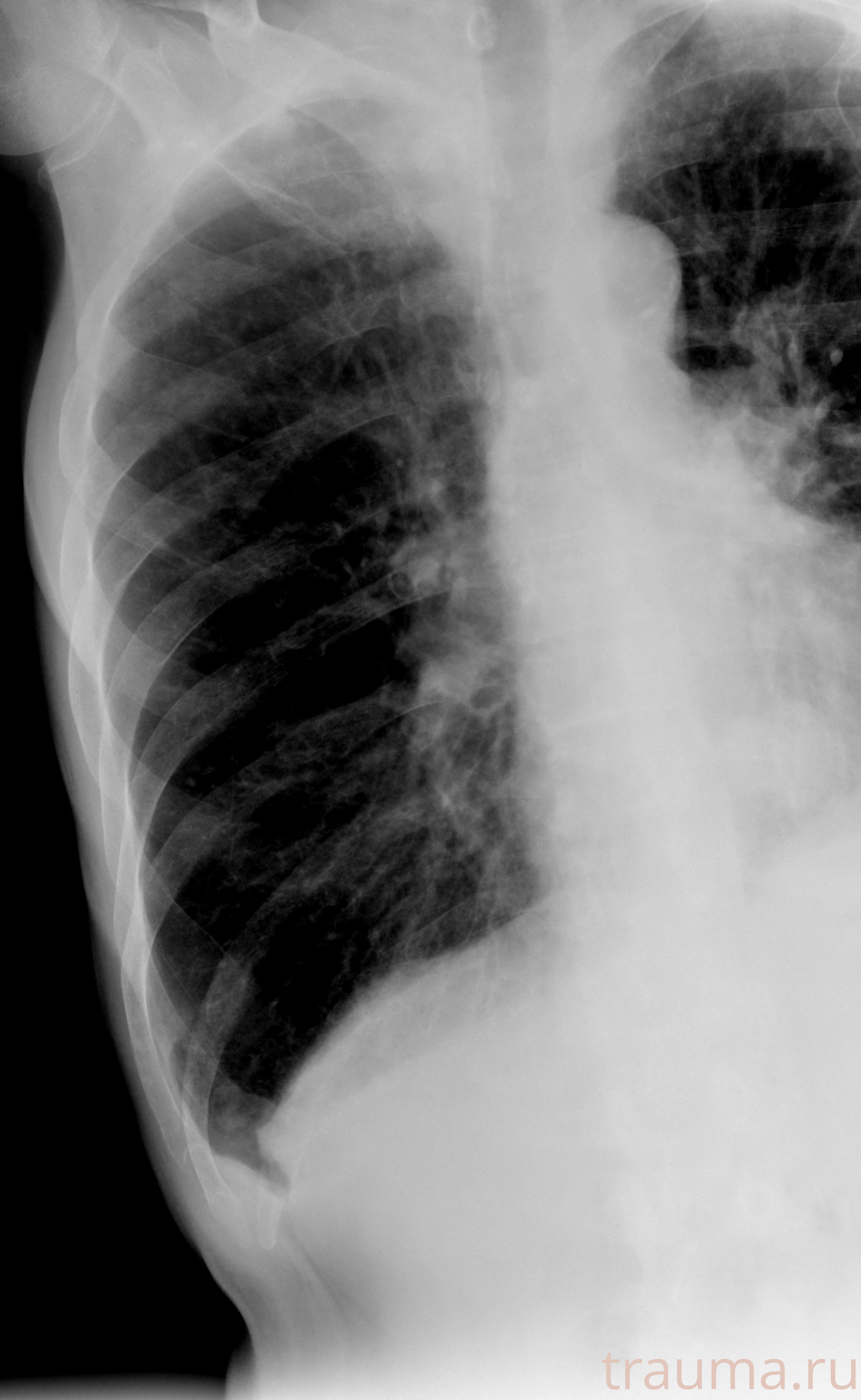 Рентген на дому: по вашему адресу приезжает врач-рентгенолог, травматолог-ортопед с мобильным рентгеновским аппаратом, проводит диагностику травмы или заболевания, делает необходимые рентгенограммы, дает рекомендации по дальнейшему лечению. Получить качественные снимки в домашних условиях возможно благодаря уникальной методике, разработанной МосРентген Центром для института  Склифосовского