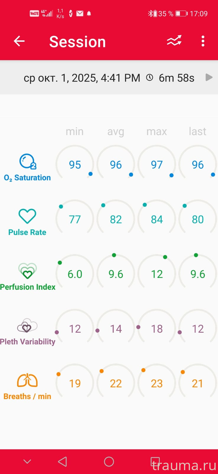 Рентген на дому: по вашему адресу приезжает врач-рентгенолог, травматолог-ортопед с мобильным рентгеновским аппаратом, проводит диагностику травмы или заболевания, делает необходимые рентгенограммы, дает рекомендации по дальнейшему лечению. Получить качественные снимки в домашних условиях возможно благодаря уникальной методике, разработанной МосРентген Центром для института  Склифосовского