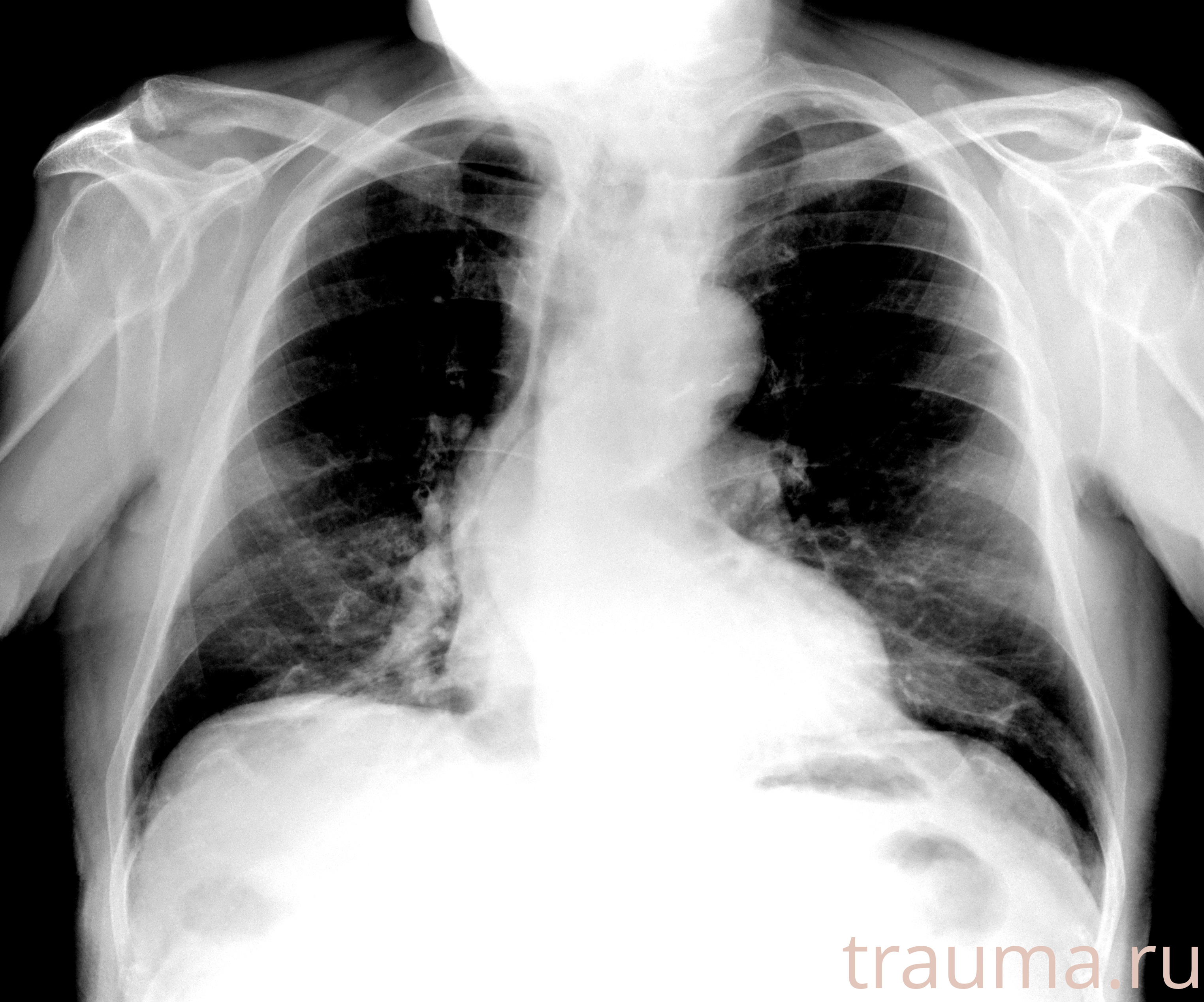 Рентген на дому: по вашему адресу приезжает врач-рентгенолог, травматолог-ортопед с мобильным рентгеновским аппаратом, проводит диагностику травмы или заболевания, делает необходимые рентгенограммы, дает рекомендации по дальнейшему лечению. Получить качественные снимки в домашних условиях возможно благодаря уникальной методике, разработанной МосРентген Центром для института  Склифосовского