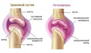 Параклинические методы оценки состояния больных, подлежащих эндопротезированию Параклинические методы оценки состояния больных, подлежащих эндопротезированию