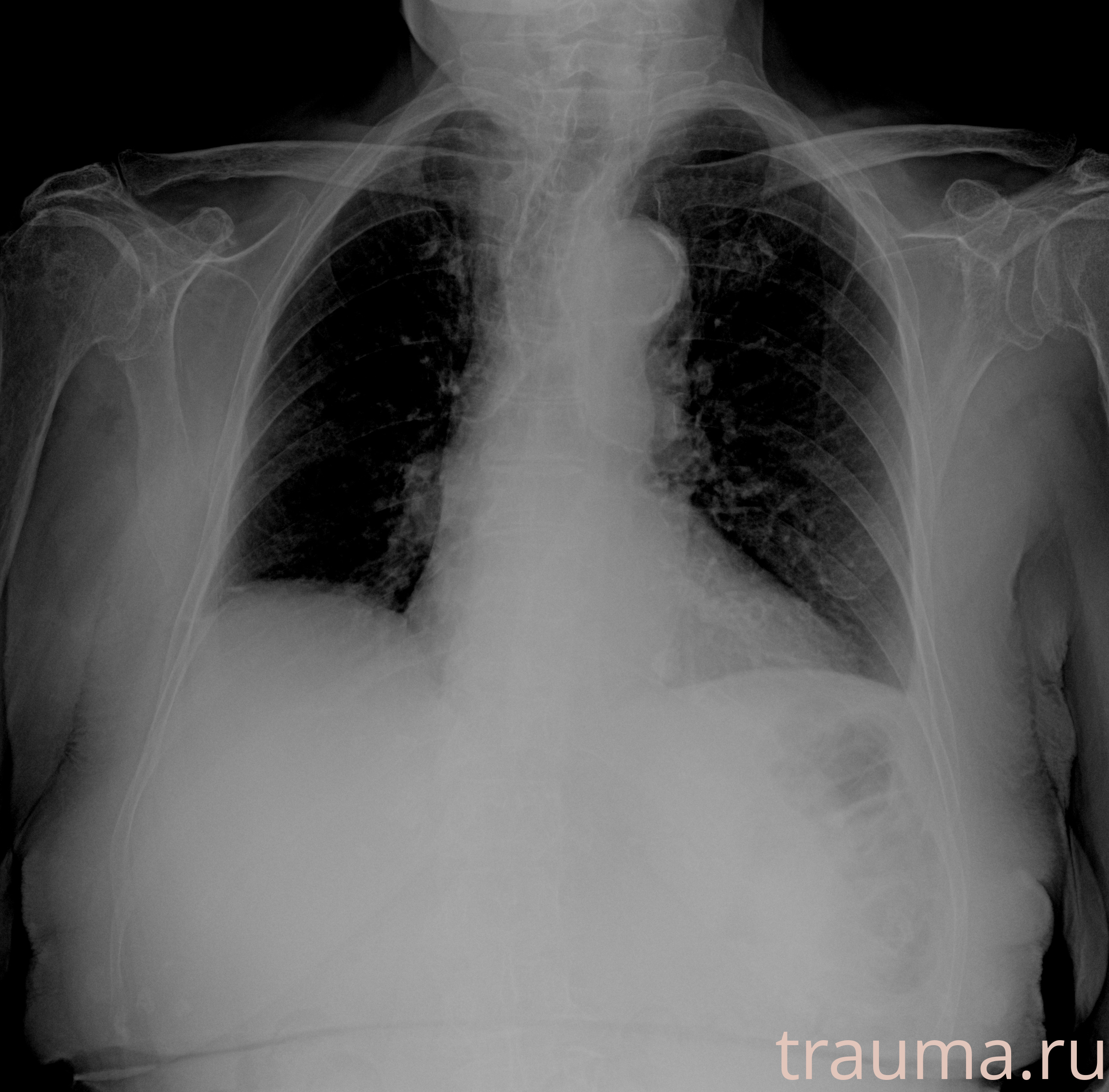 Рентген на дому: по вашему адресу приезжает врач-рентгенолог, травматолог-ортопед с мобильным рентгеновским аппаратом, проводит диагностику травмы или заболевания, делает необходимые рентгенограммы, дает рекомендации по дальнейшему лечению. Получить качественные снимки в домашних условиях возможно благодаря уникальной методике, разработанной МосРентген Центром для института  Склифосовского