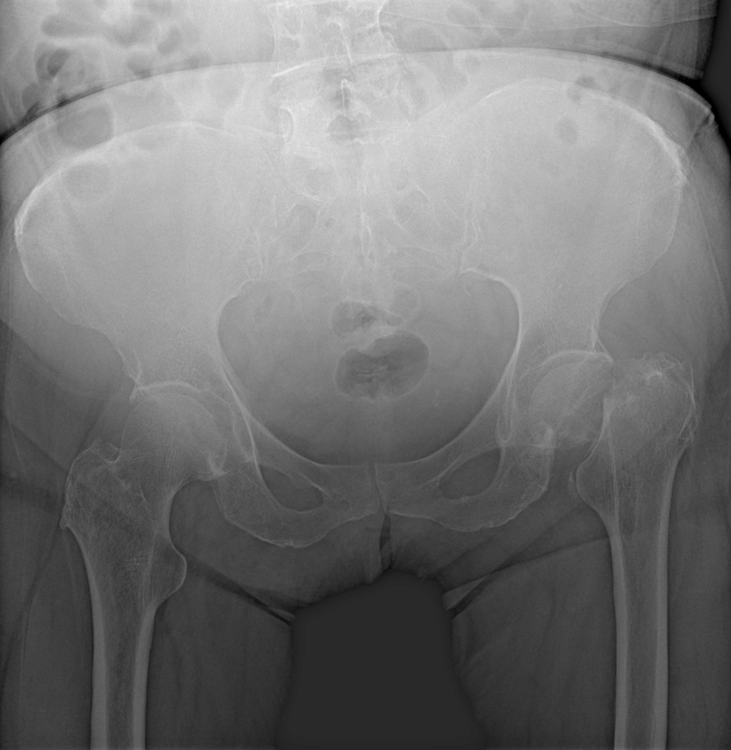 Рентген на дому: по вашему адресу приезжает врач-рентгенолог, травматолог-ортопед с мобильным рентгеновским аппаратом, проводит диагностику травмы или заболевания, делает необходимые рентгенограммы, дает рекомендации по дальнейшему лечению. Получить качественные снимки в домашних условиях возможно благодаря уникальной методике, разработанной МосРентген Центром для института  Склифосовского